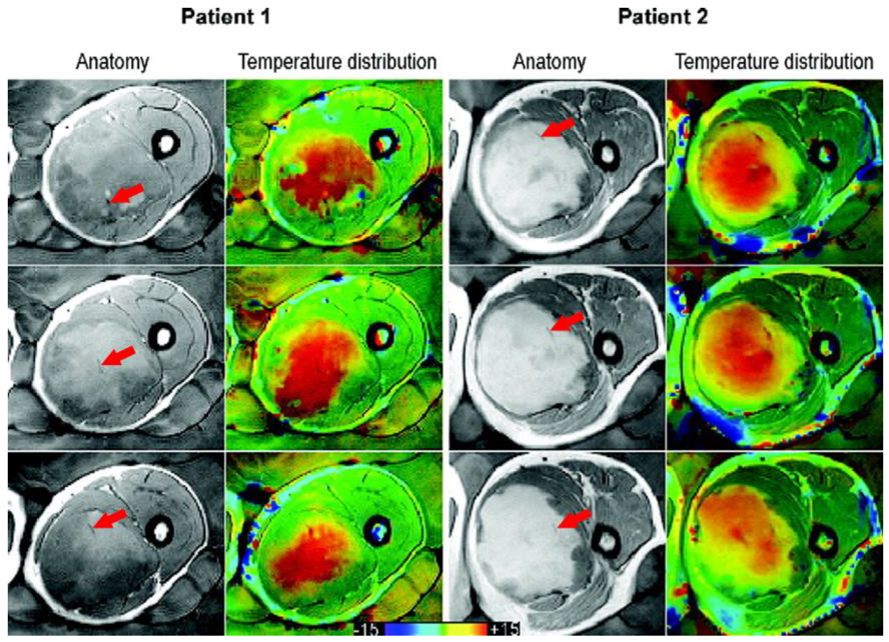 Cancers 13 00031 g001