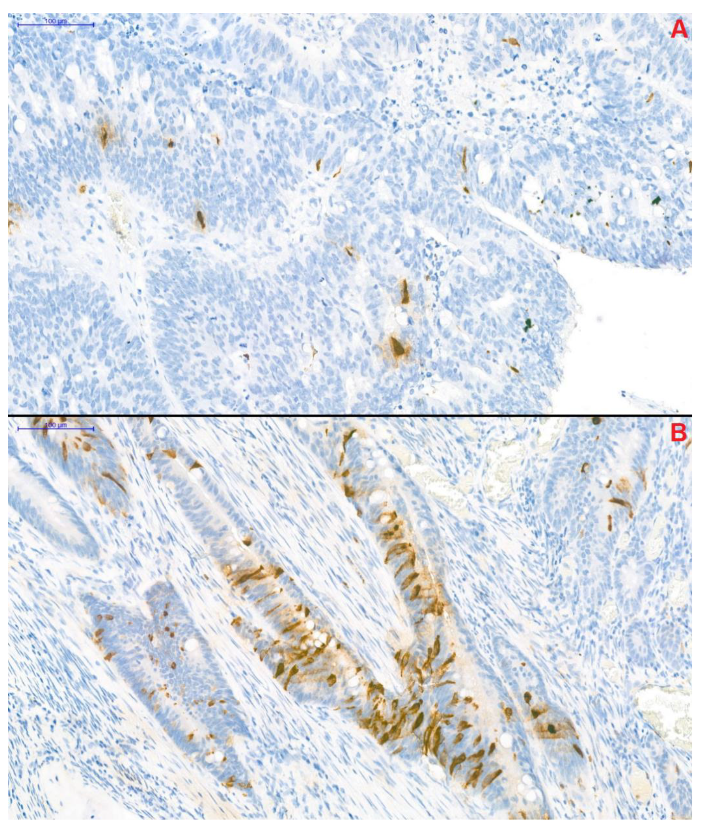 Cancers 13 00067 g003