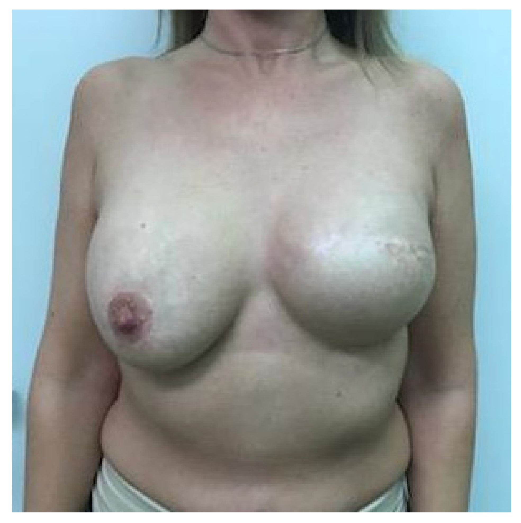 Cancers 13 00073 g001