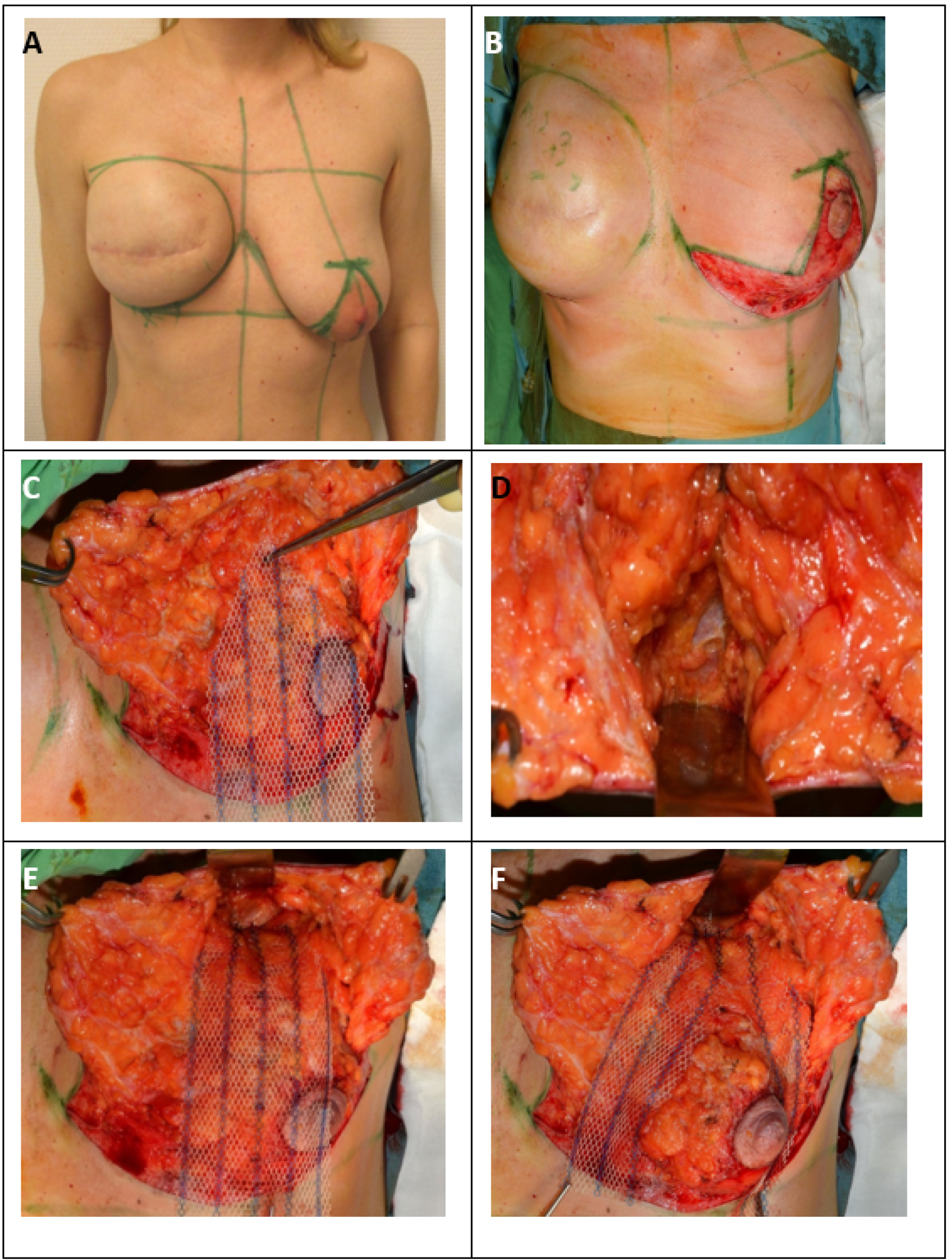 Cancers 13 00073 g002a