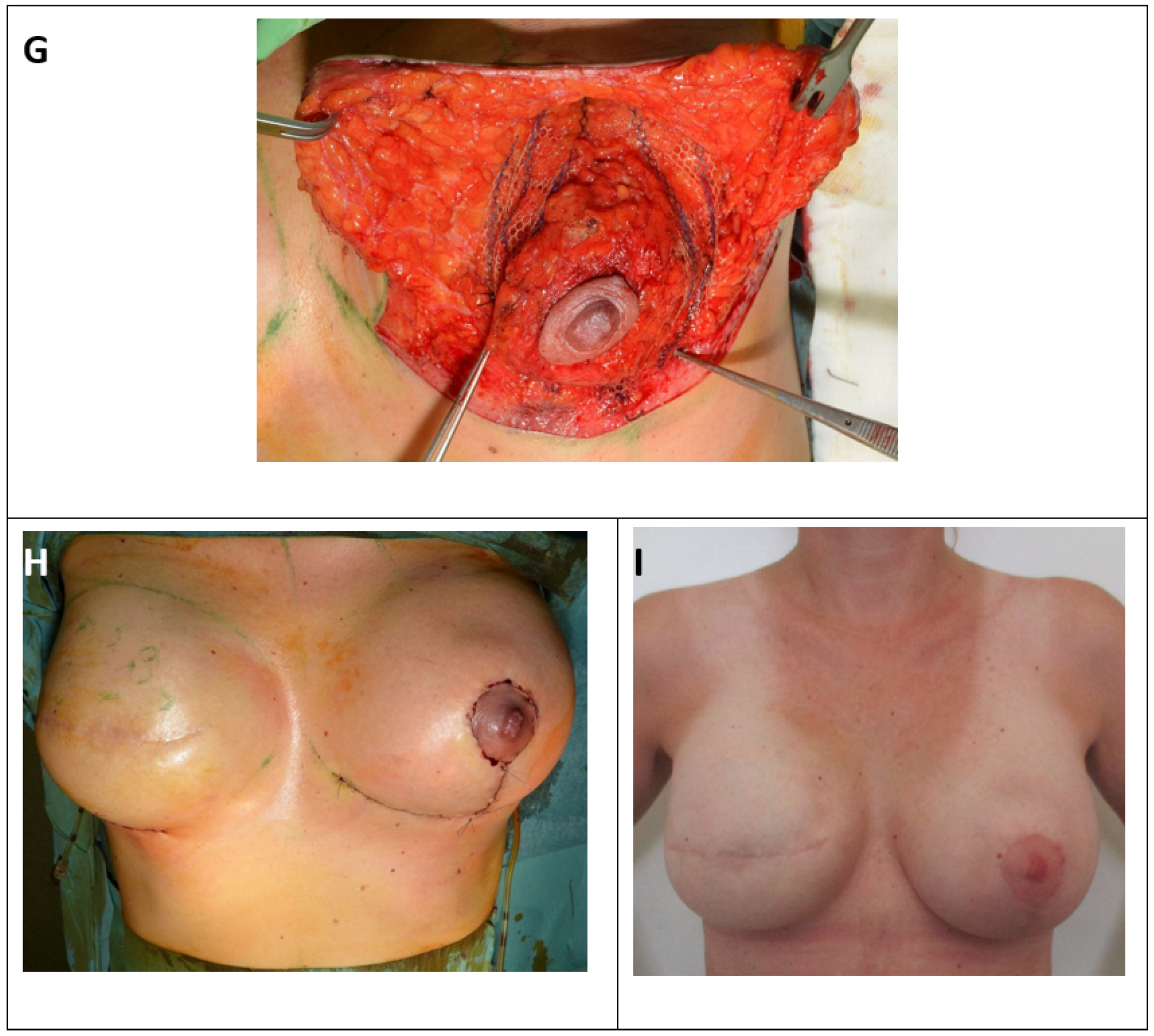 Cancers 13 00073 g002b