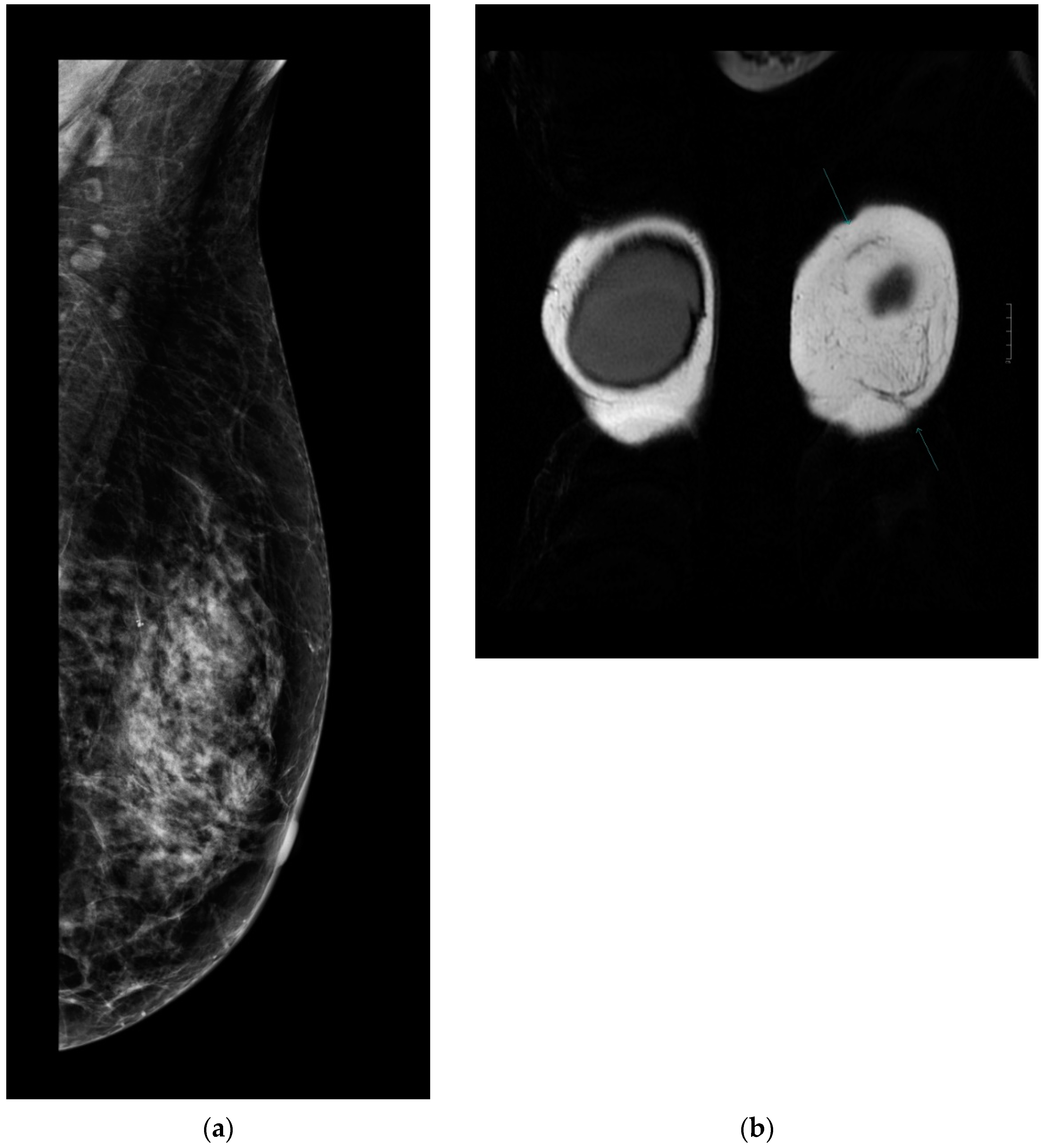 Cancers 13 00073 g004