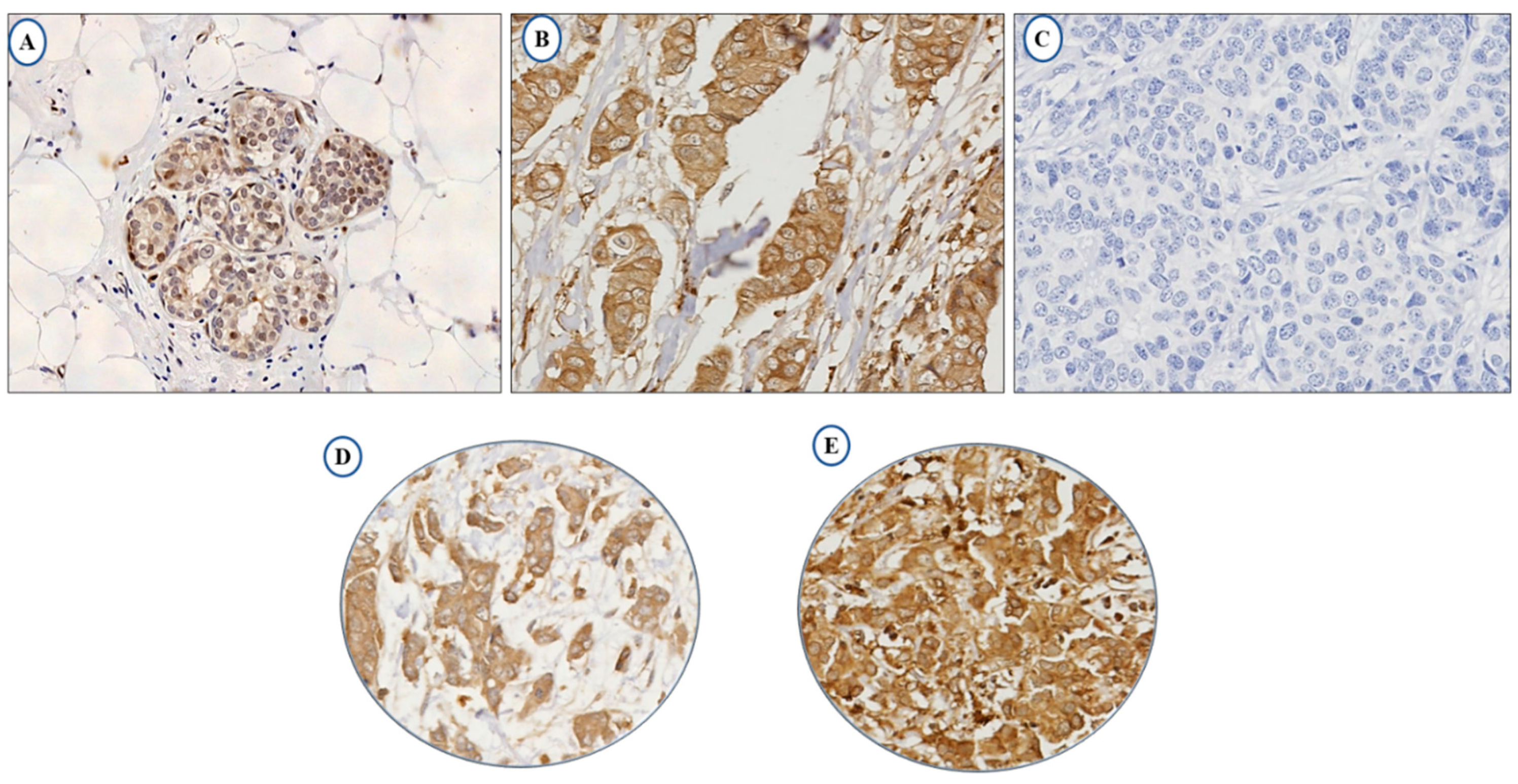 Cancers 13 00080 g001