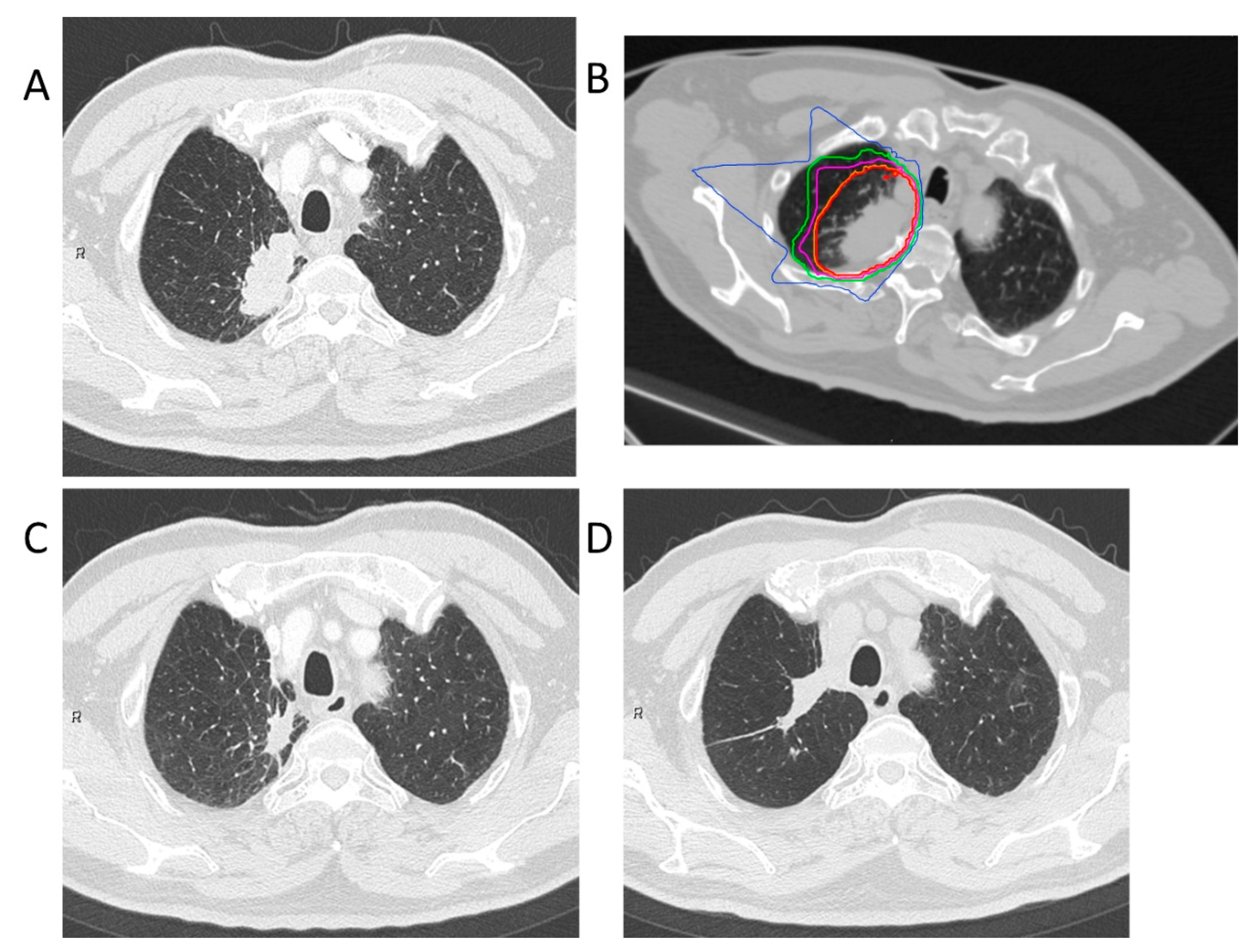 Cancers 13 00112 g003