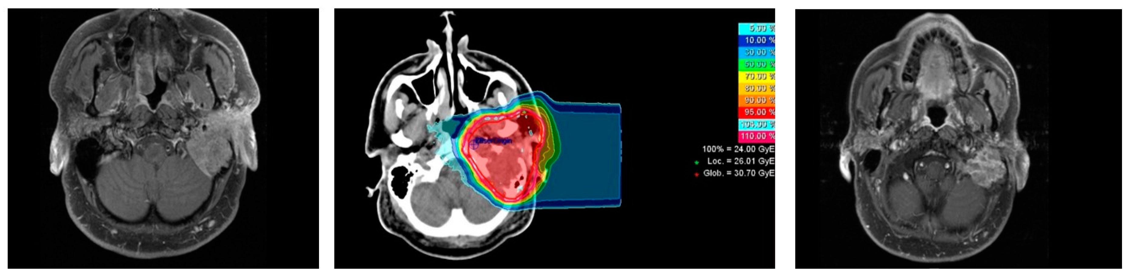 Cancers 13 00124 g001