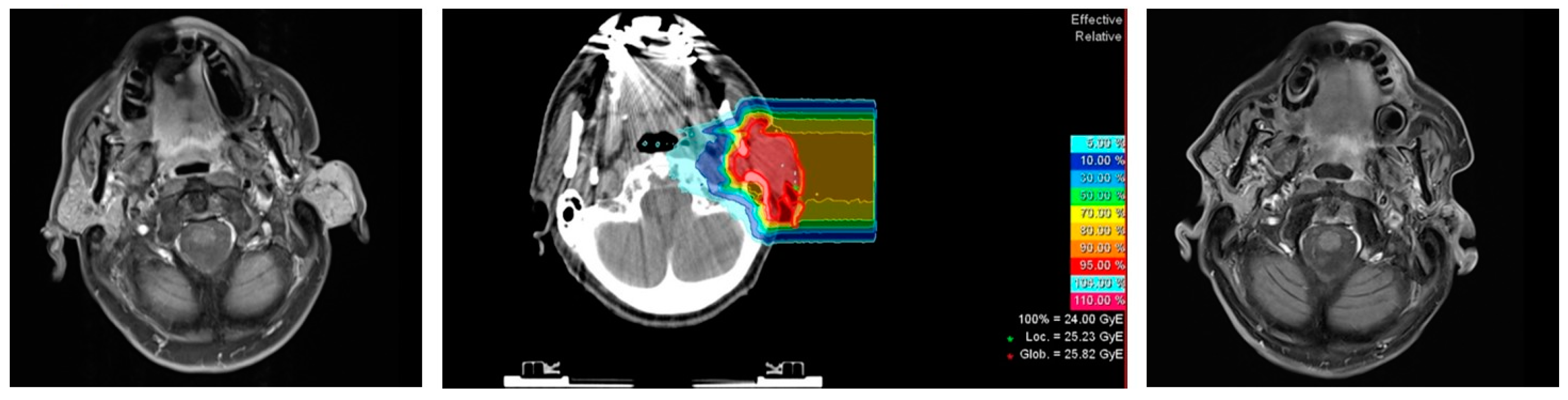 Cancers 13 00124 g002