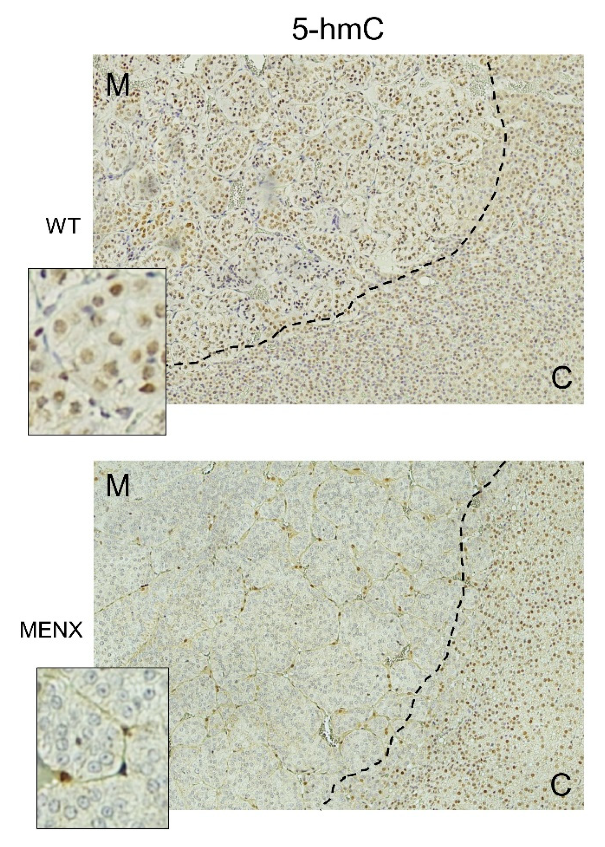 Cancers 13 00126 g004