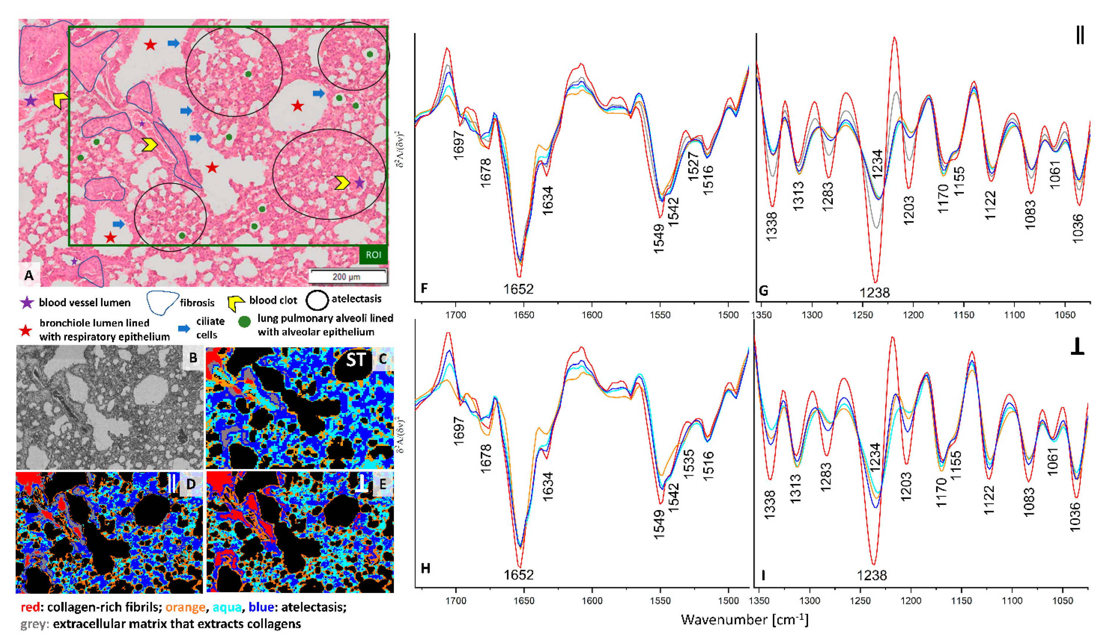Cancers 13 00162 g002 Cancers 13 00162 g002