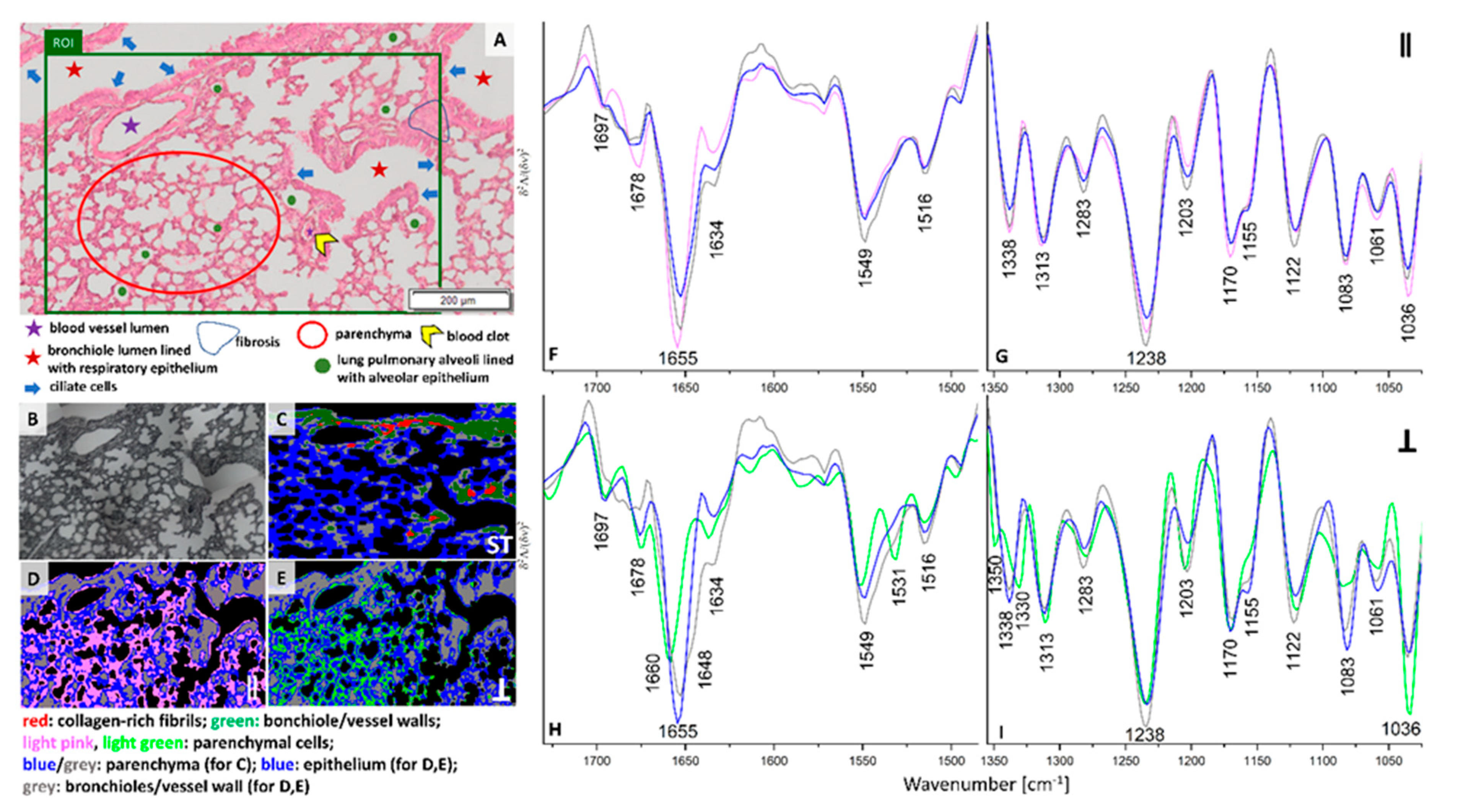 Cancers 13 00162 g003 Cancers 13 00162 g003