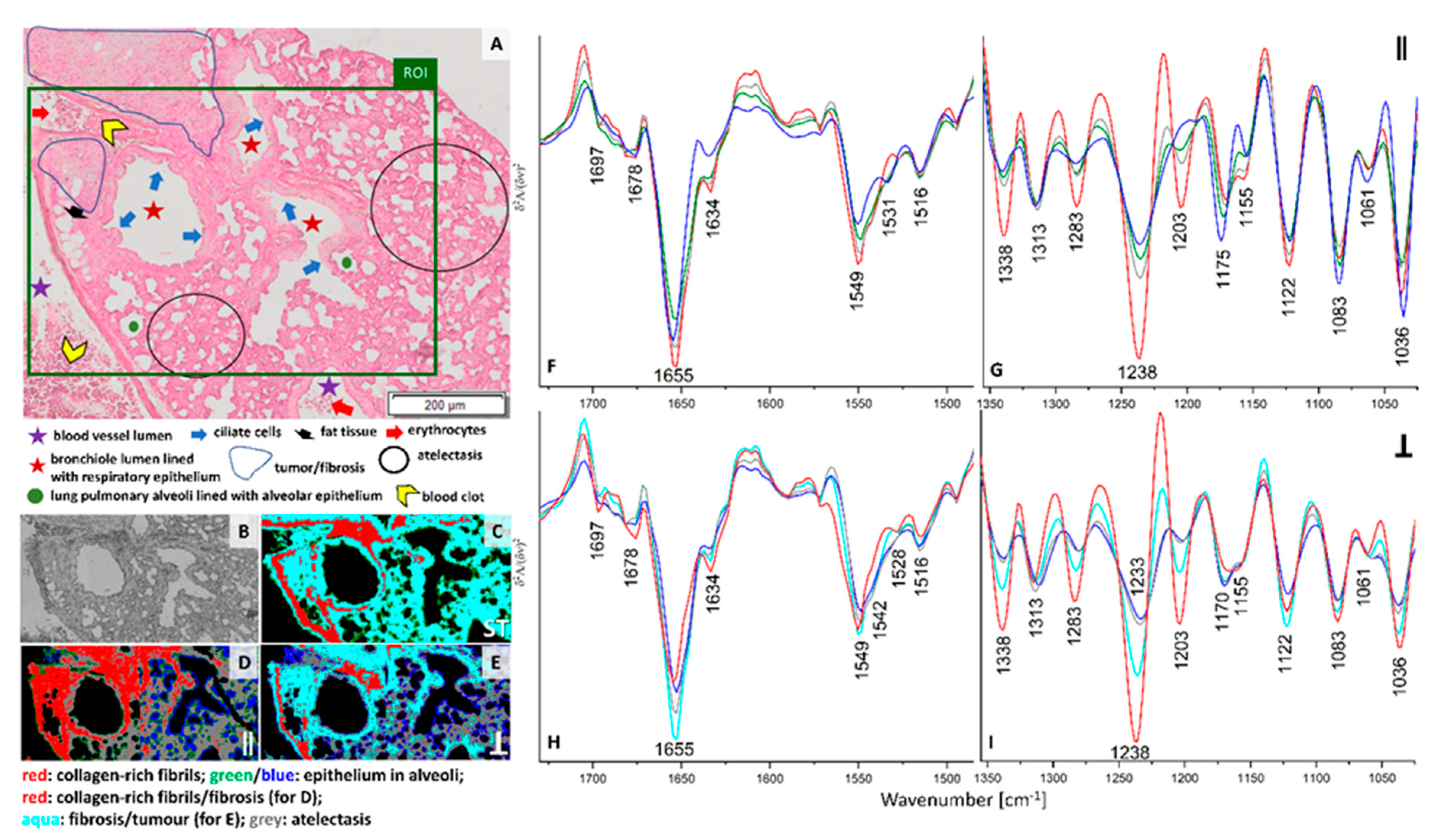Cancers 13 00162 g004 Cancers 13 00162 g004