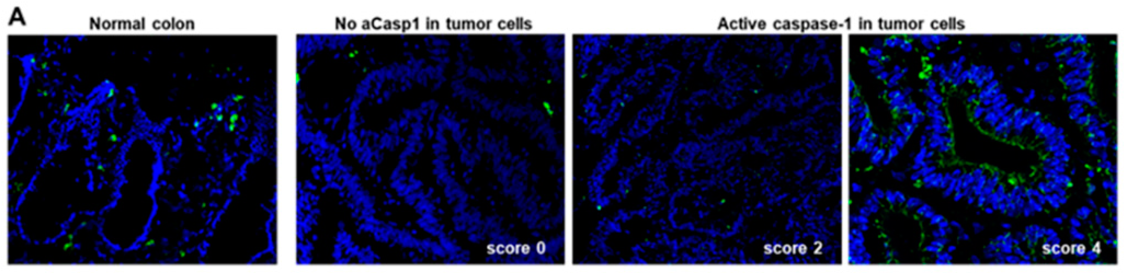 Cancers 13 00189 g002a