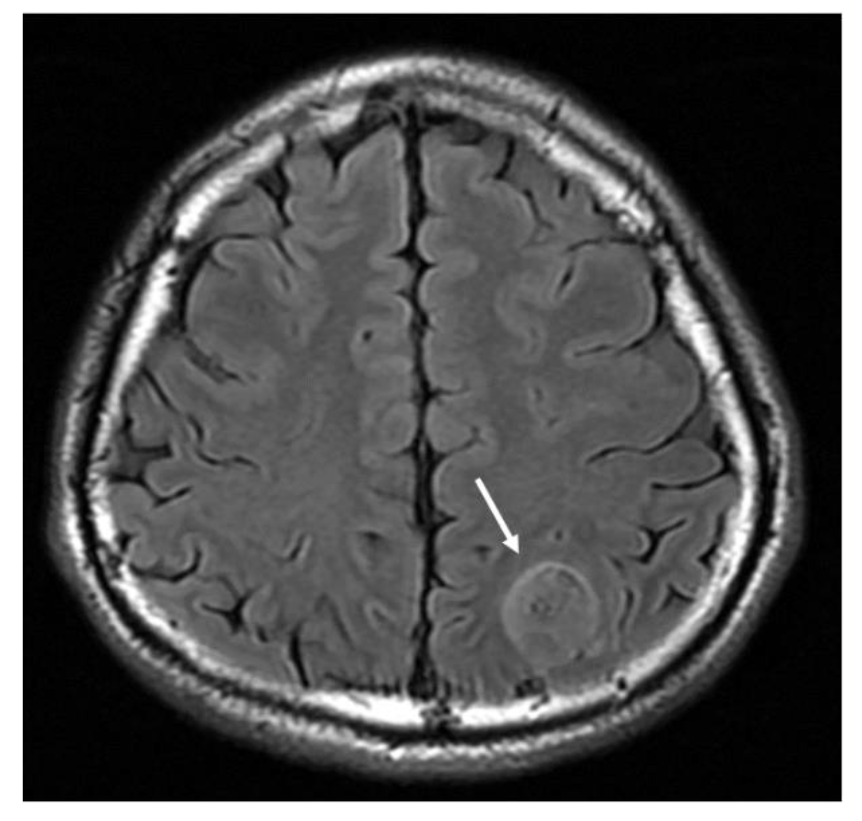 Cancers 13 00195 g002