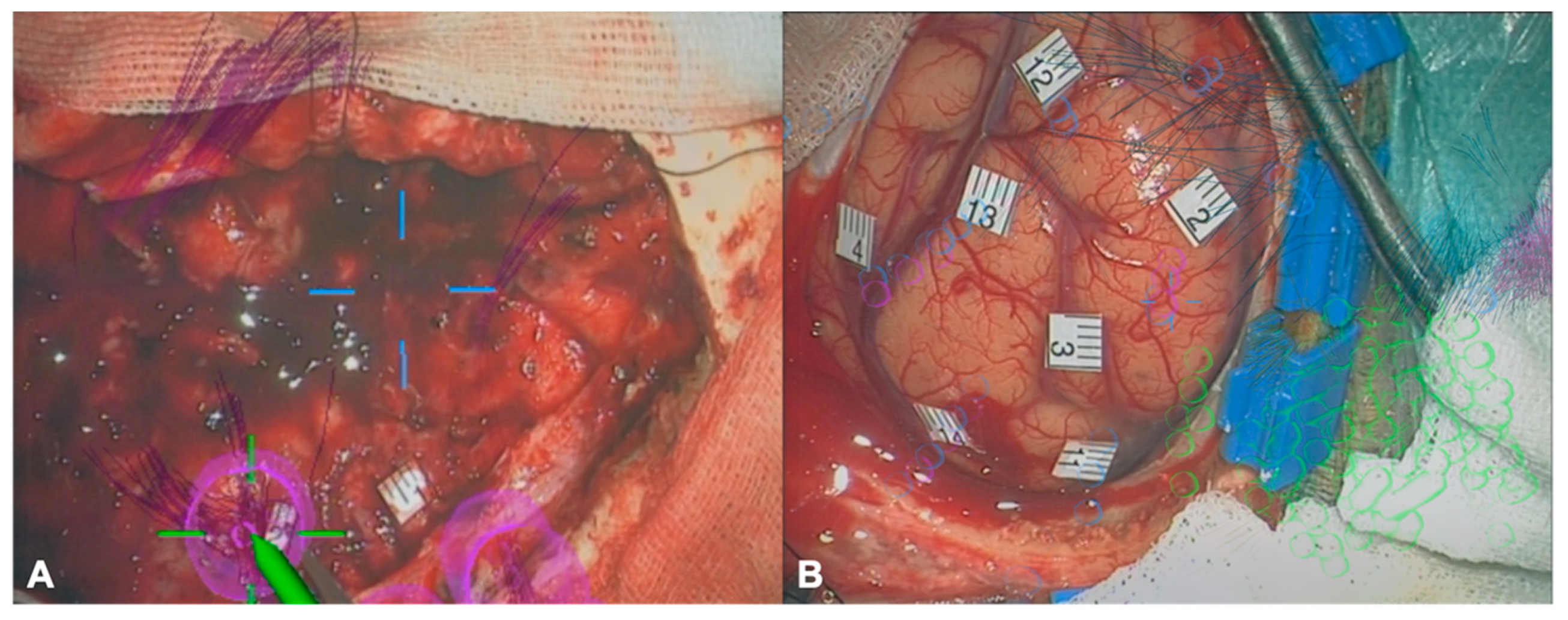 Cancers 13 00207 g002 Cancers 13 00207 g002