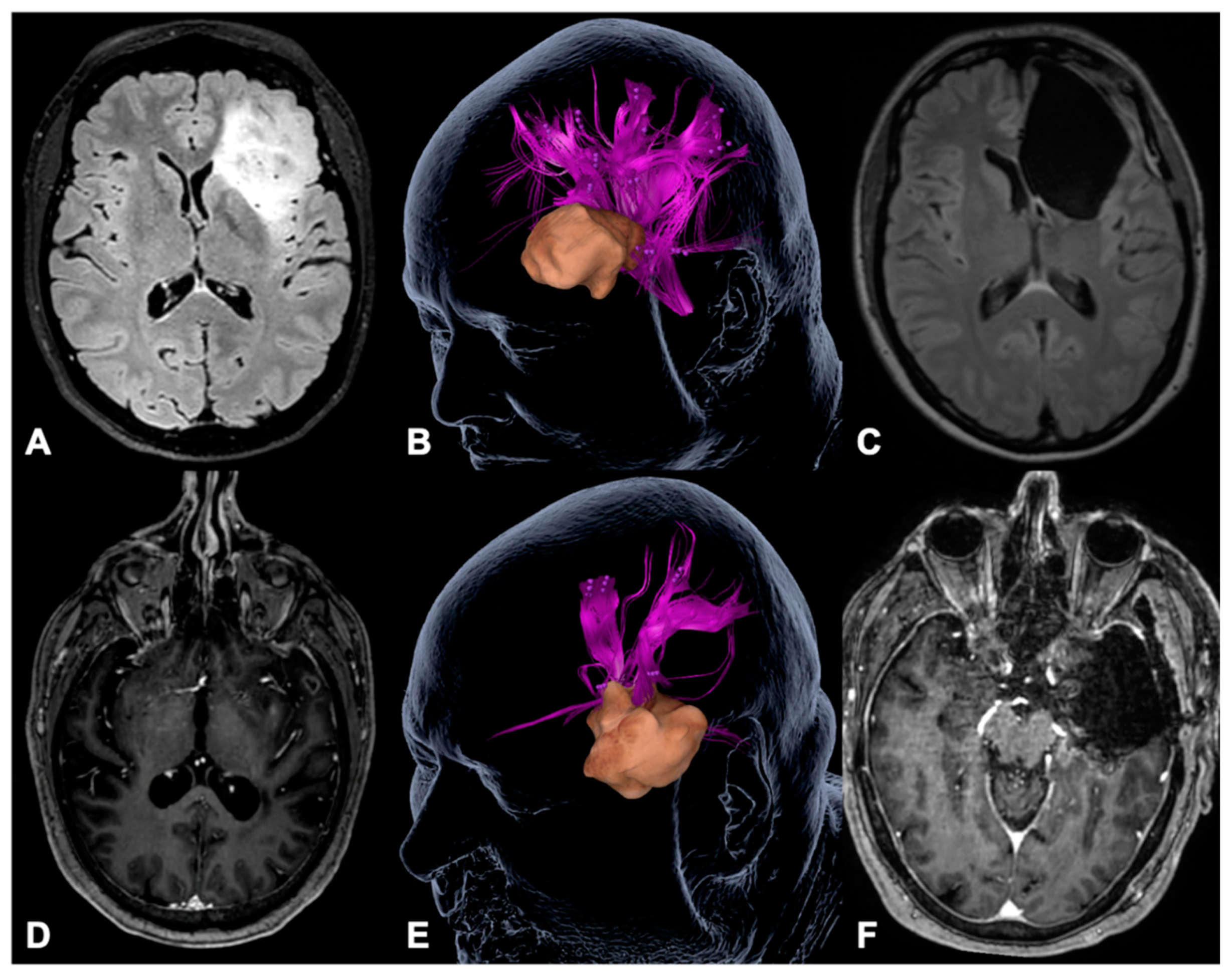 Cancers 13 00207 g005 Cancers 13 00207 g005