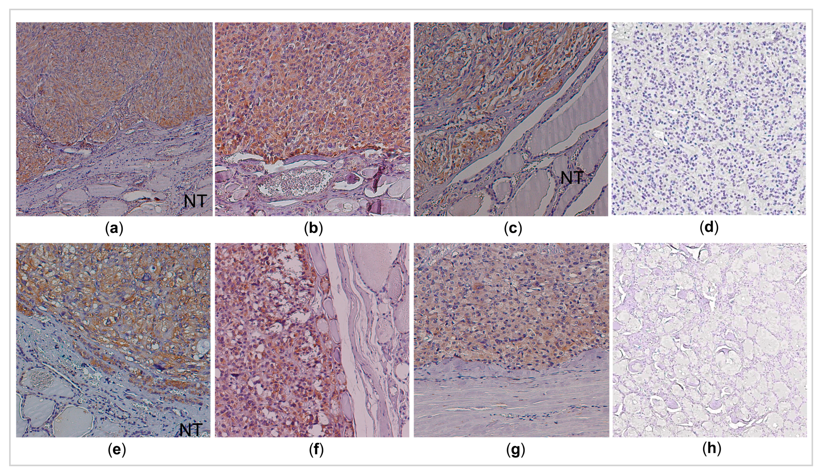 Cancers 13 00218 g003