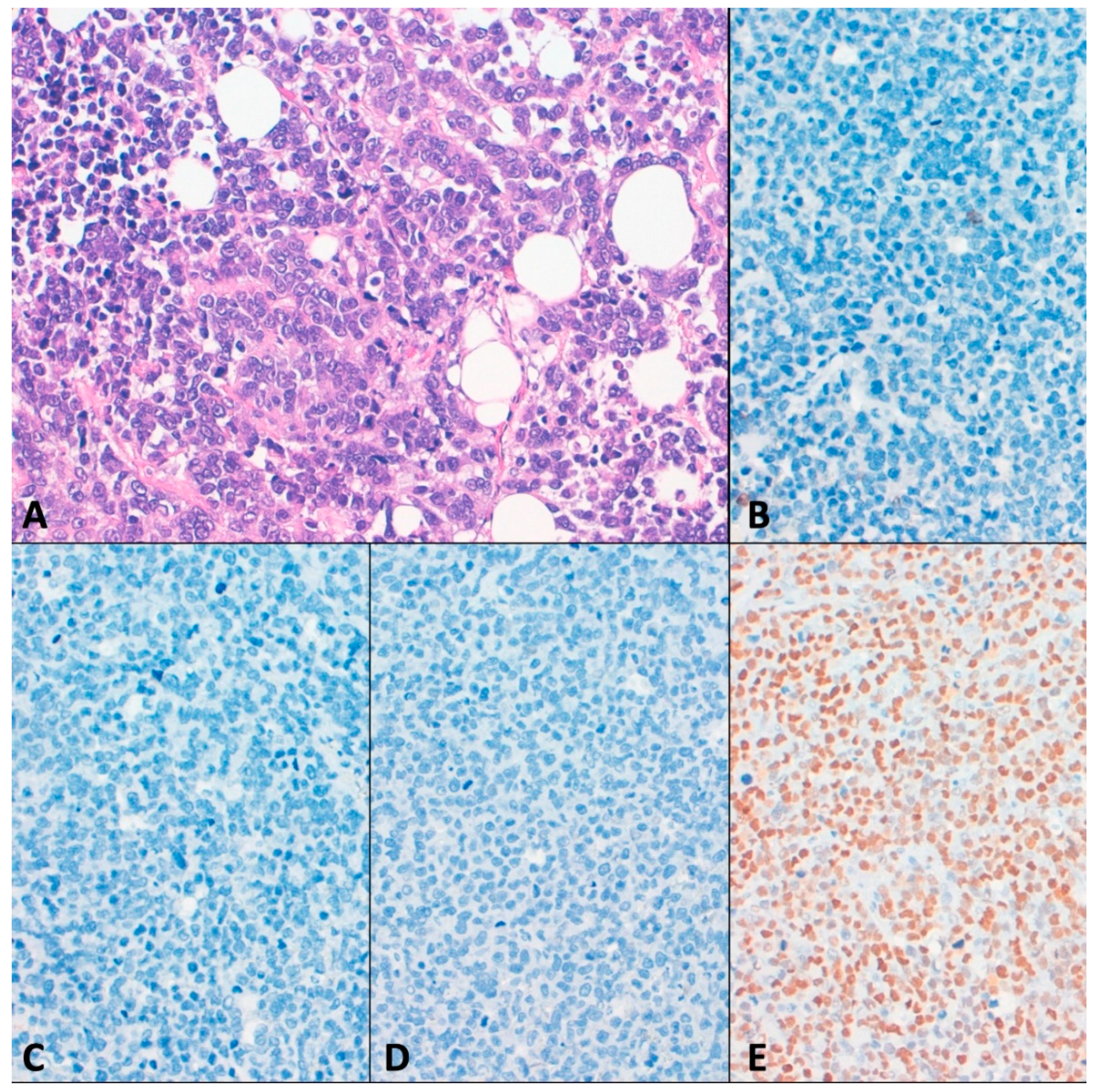 Cancers 13 00233 g004