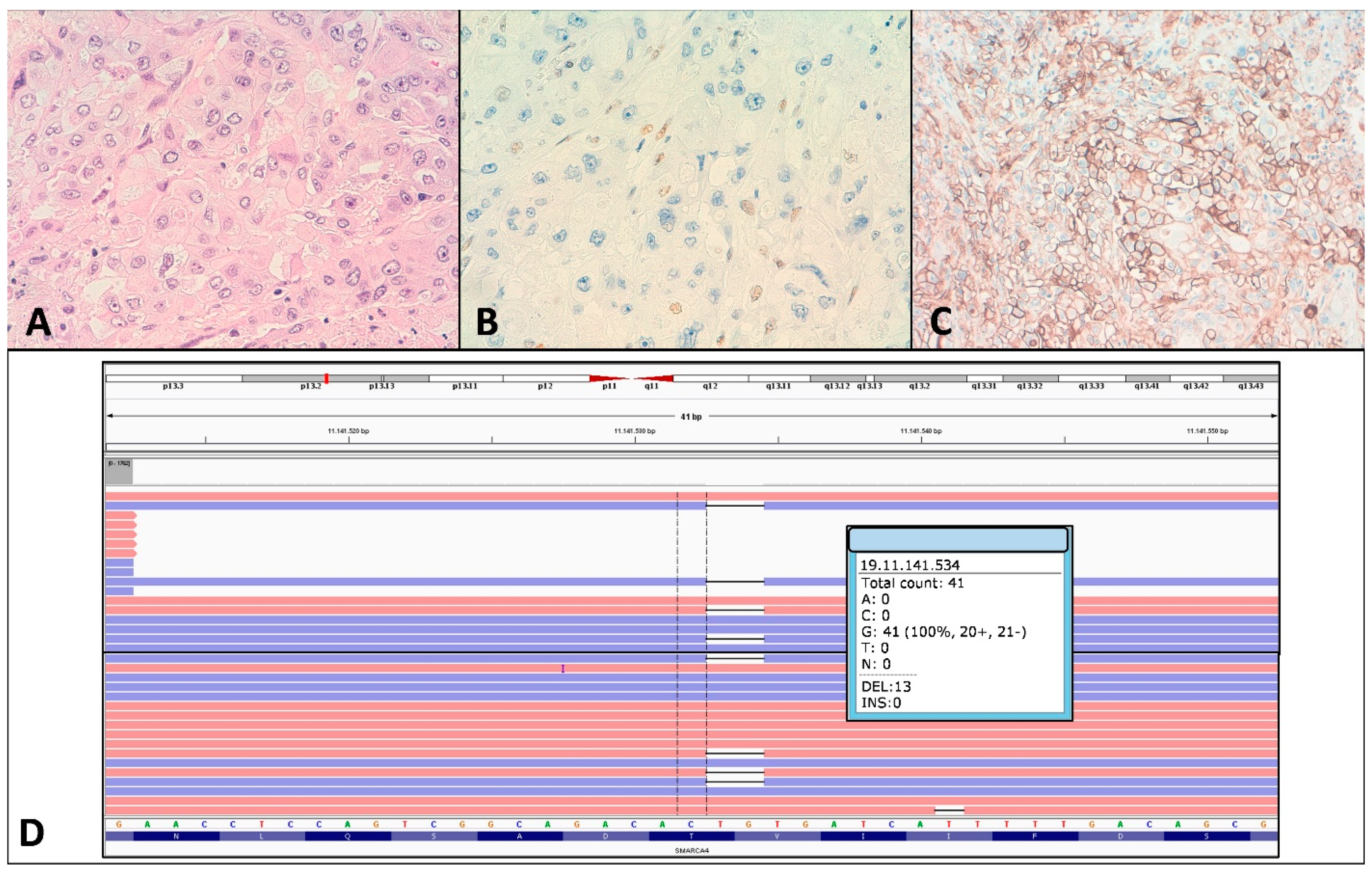 Cancers 13 00233 g005