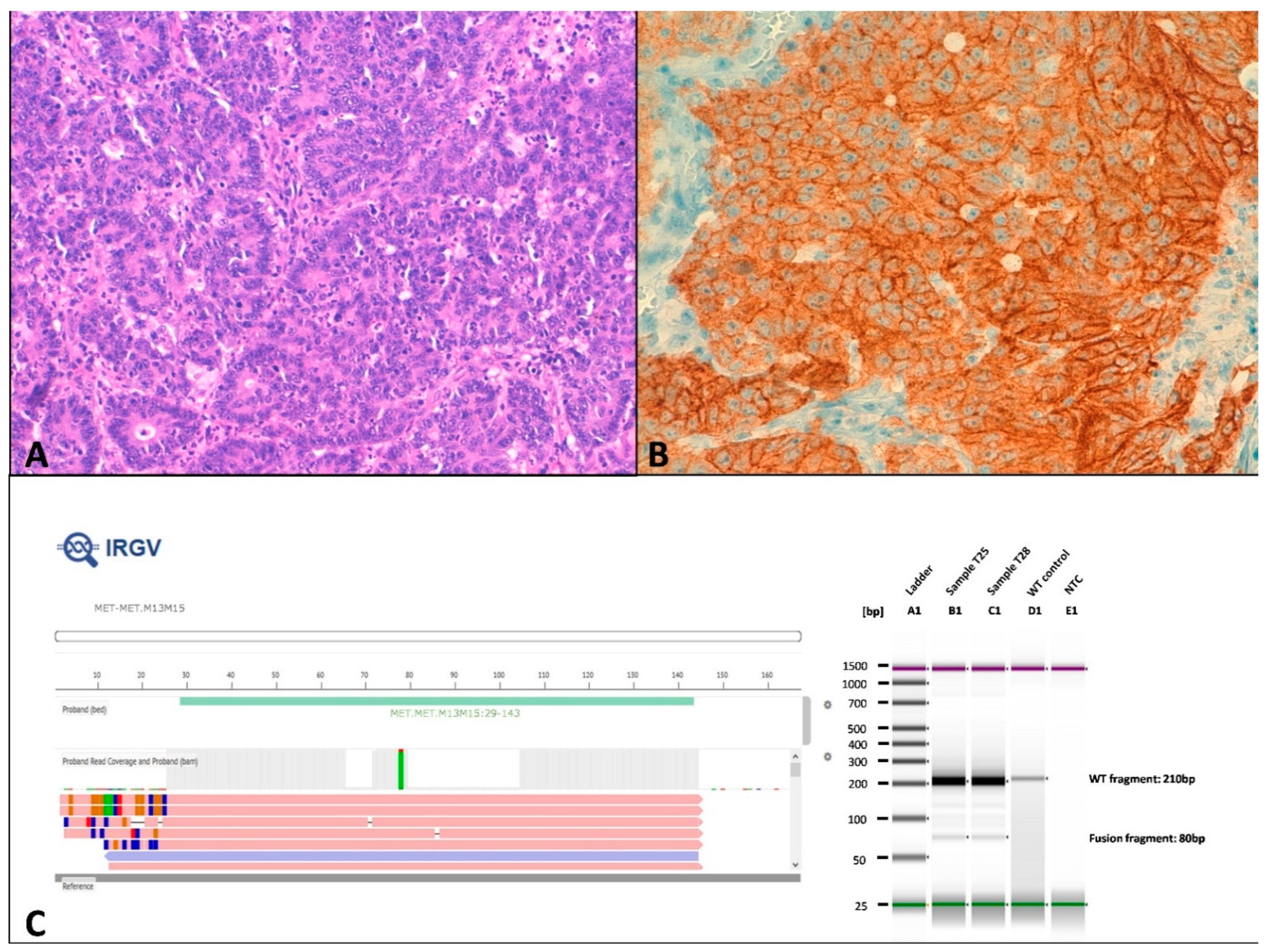 Cancers 13 00233 g006