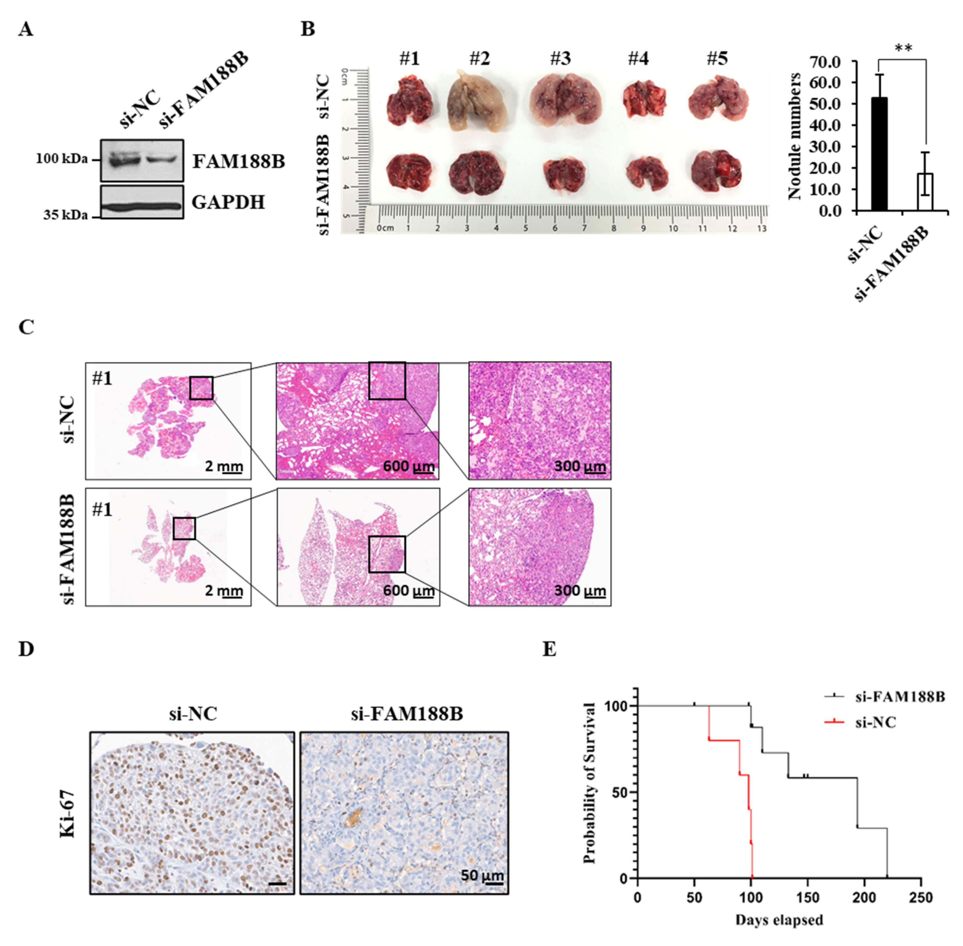 Cancers 13 00247 g005