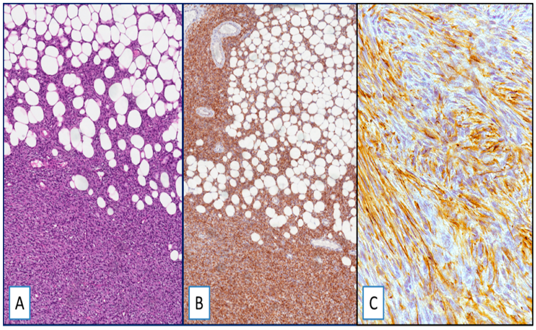 Cancers 13 00252 g001