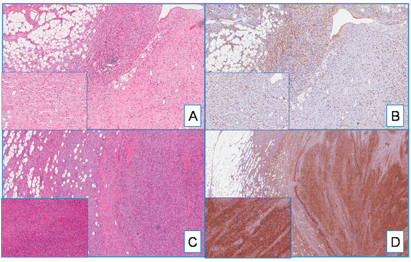 Cancers 13 00252 g002