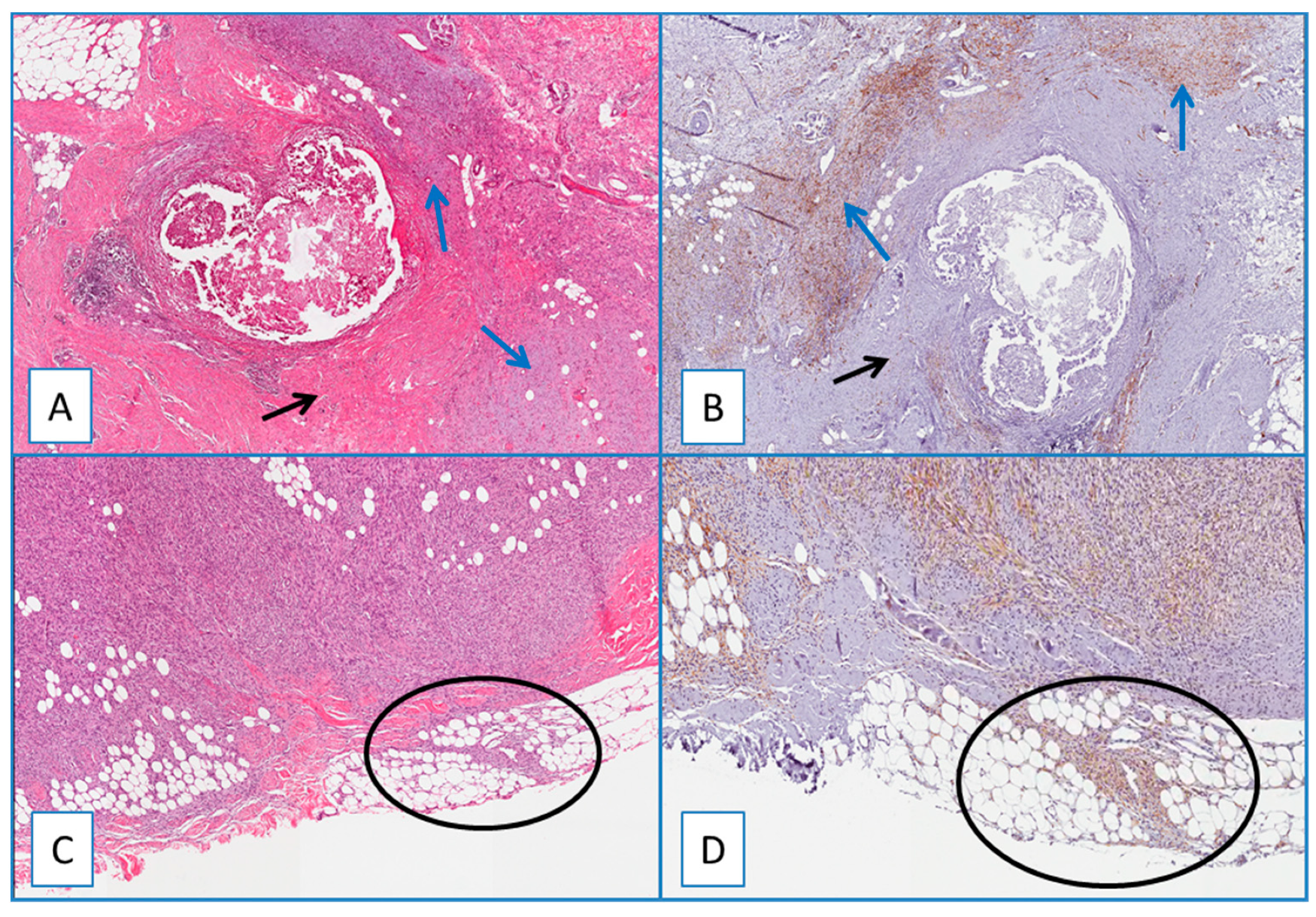 Cancers 13 00252 g003