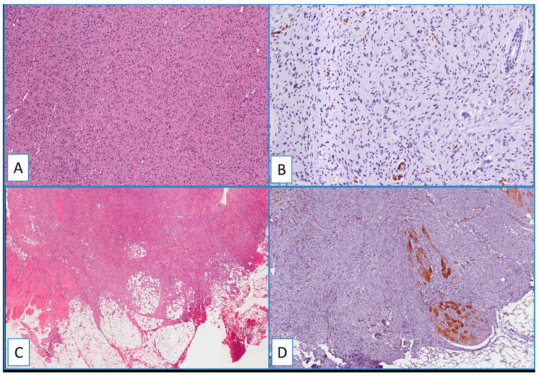 Cancers 13 00252 g004