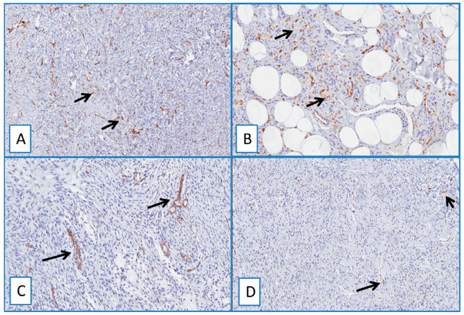 Cancers 13 00252 g005