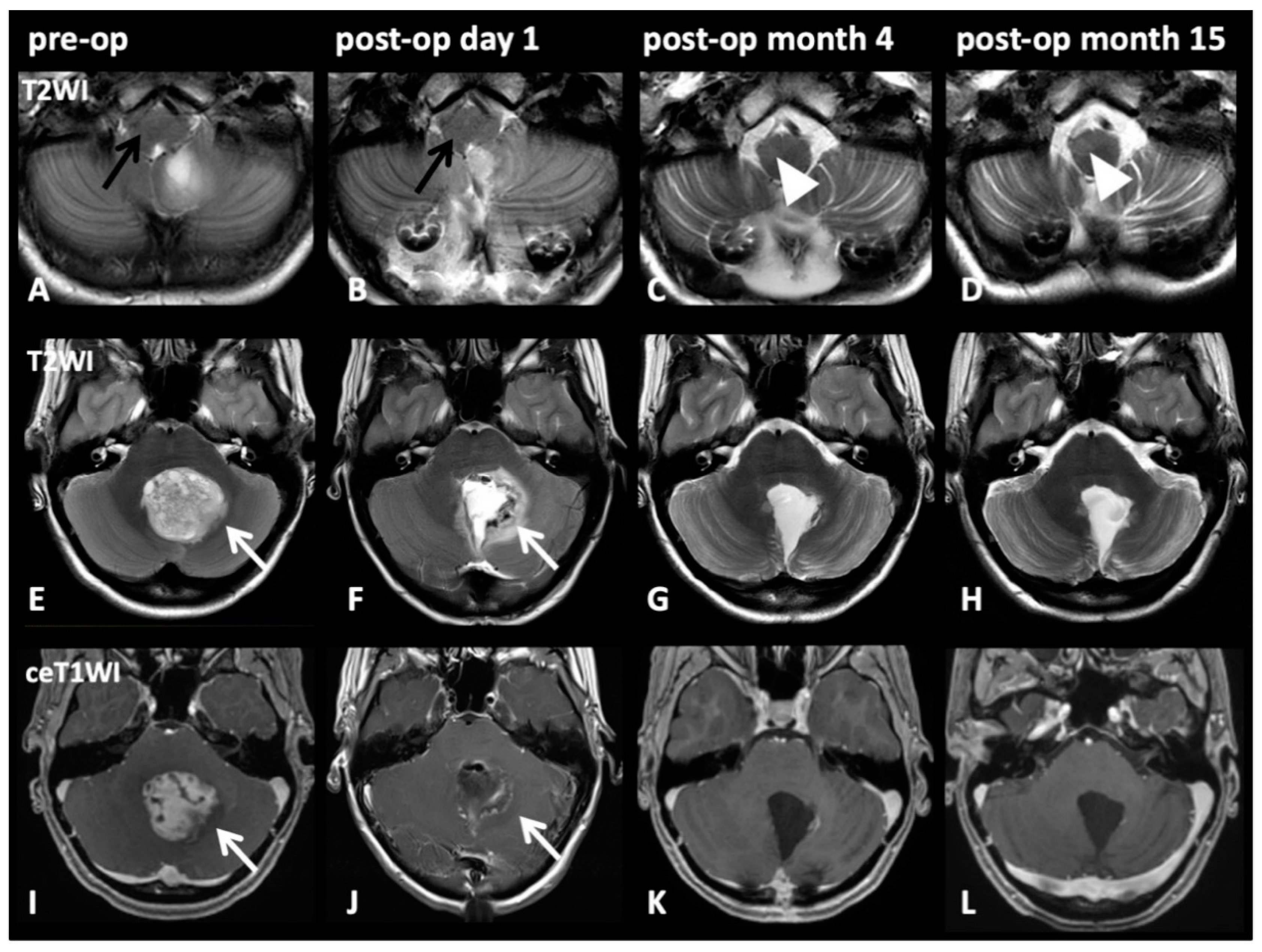 Cancers 13 00258 g004