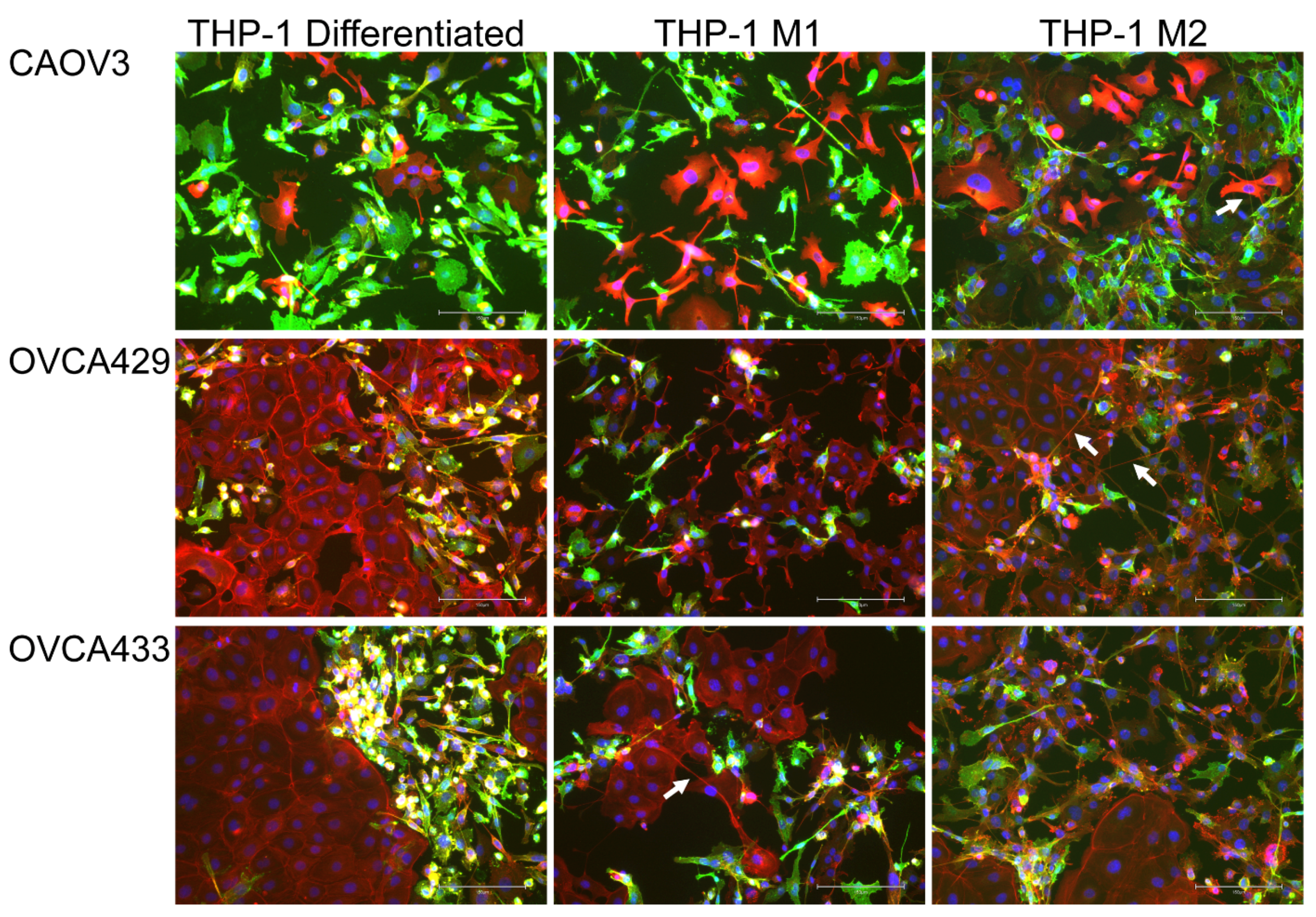 Cancers 13 00274 g002