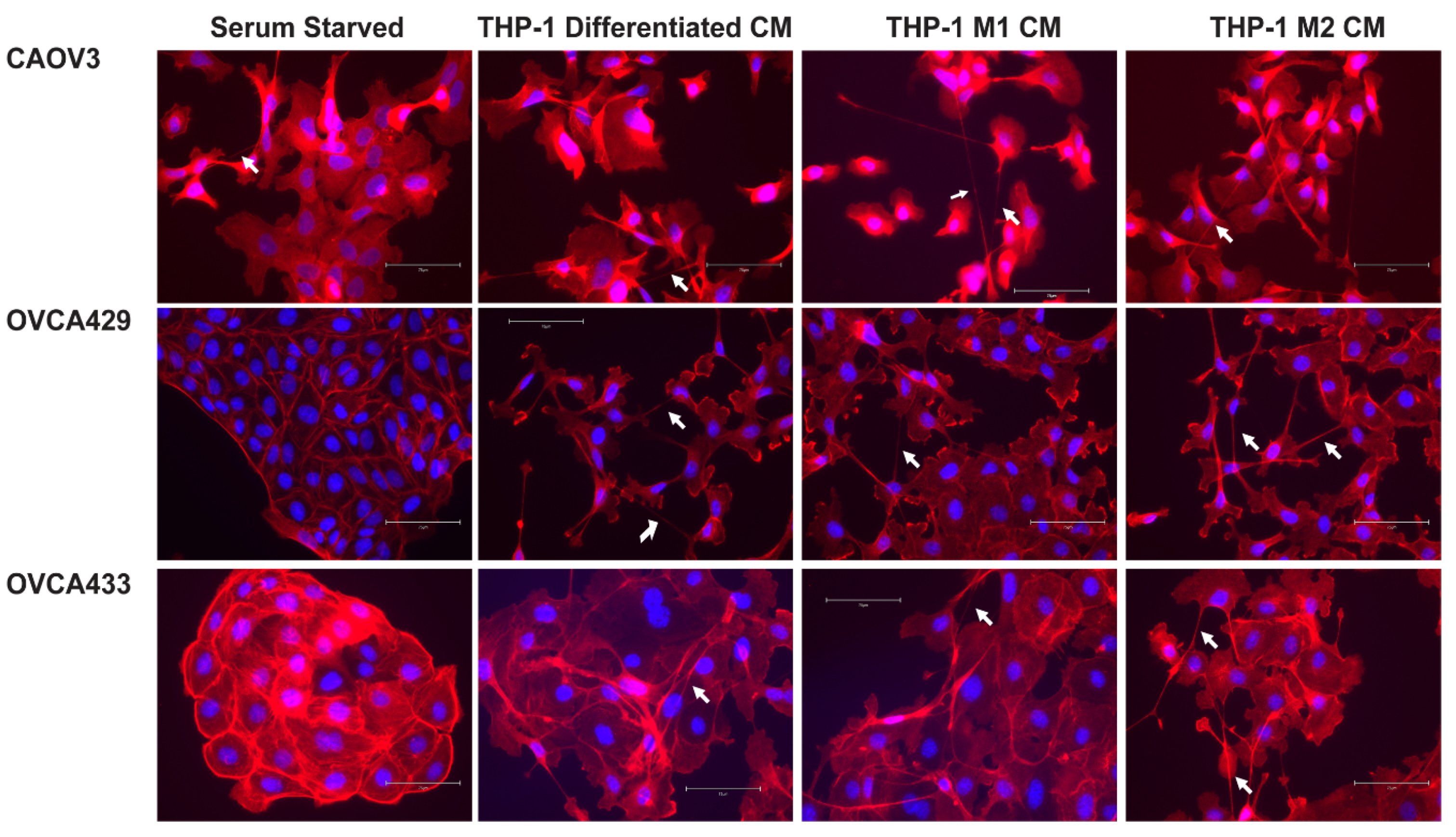 Cancers 13 00274 g003