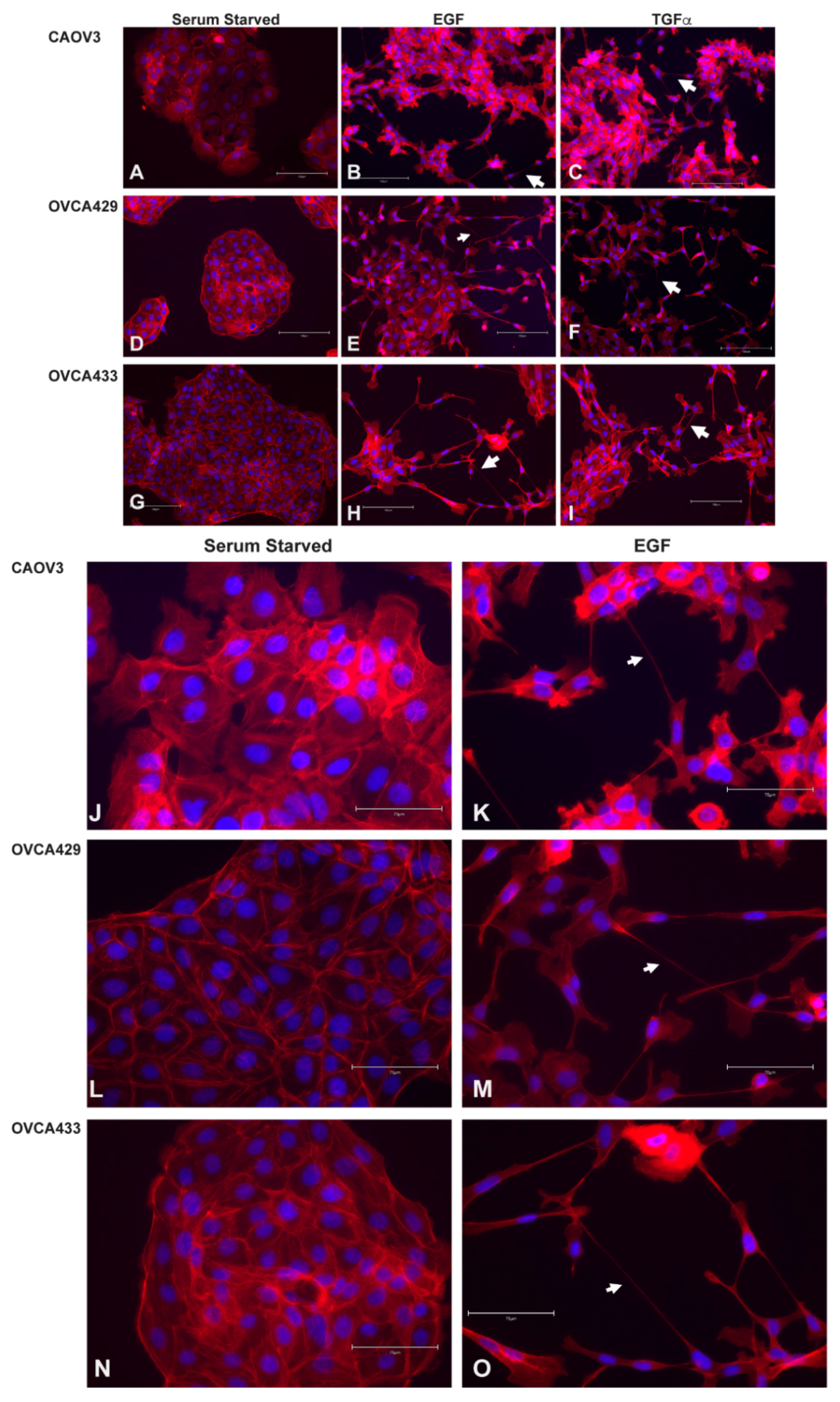 Cancers 13 00274 g004