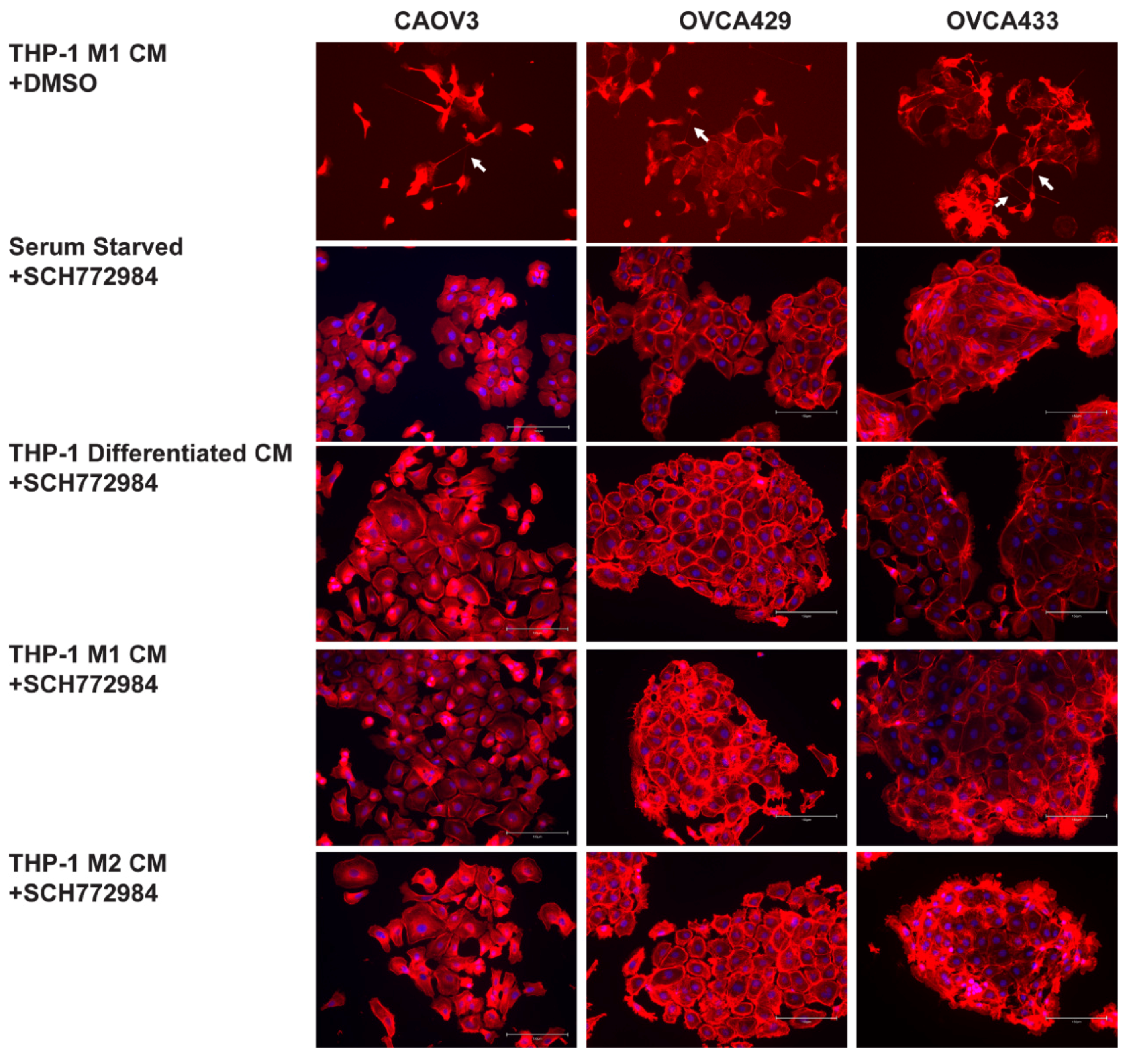 Cancers 13 00274 g006