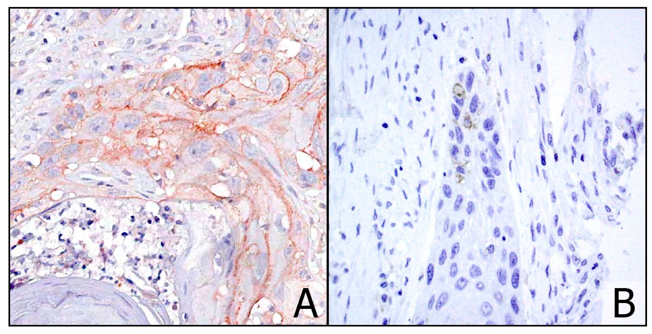 Cancers 13 00292 g002