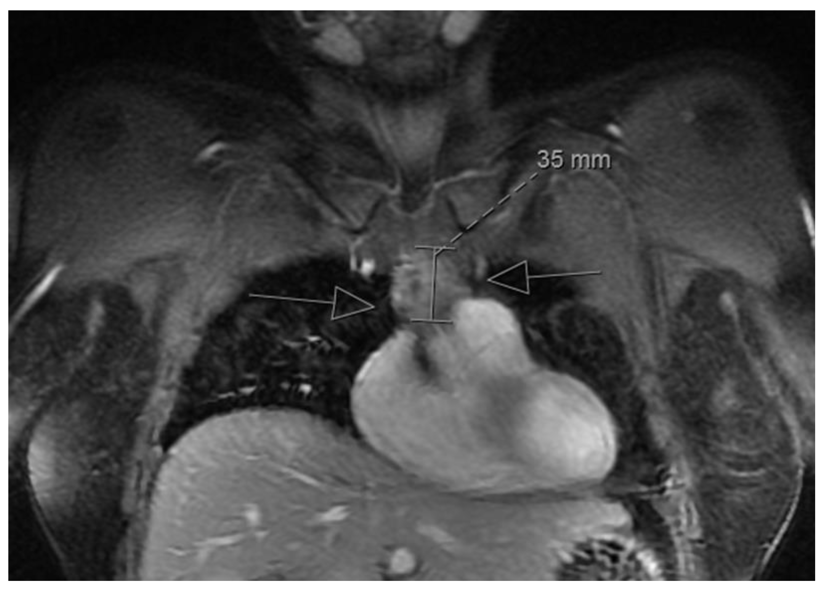 Cancers 13 00315 g001