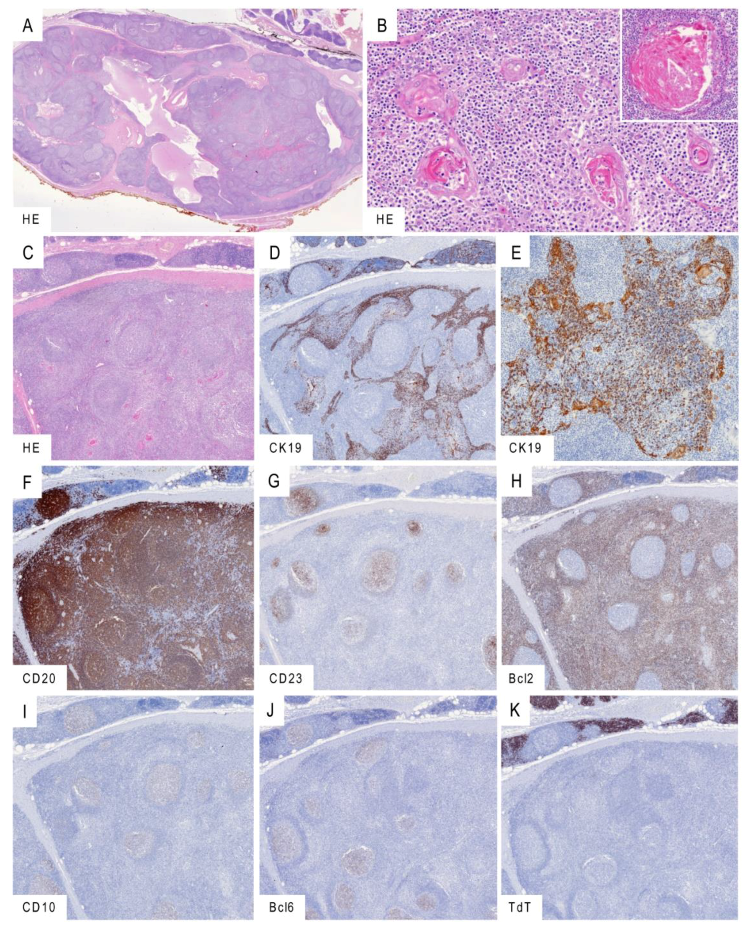 Cancers 13 00315 g002