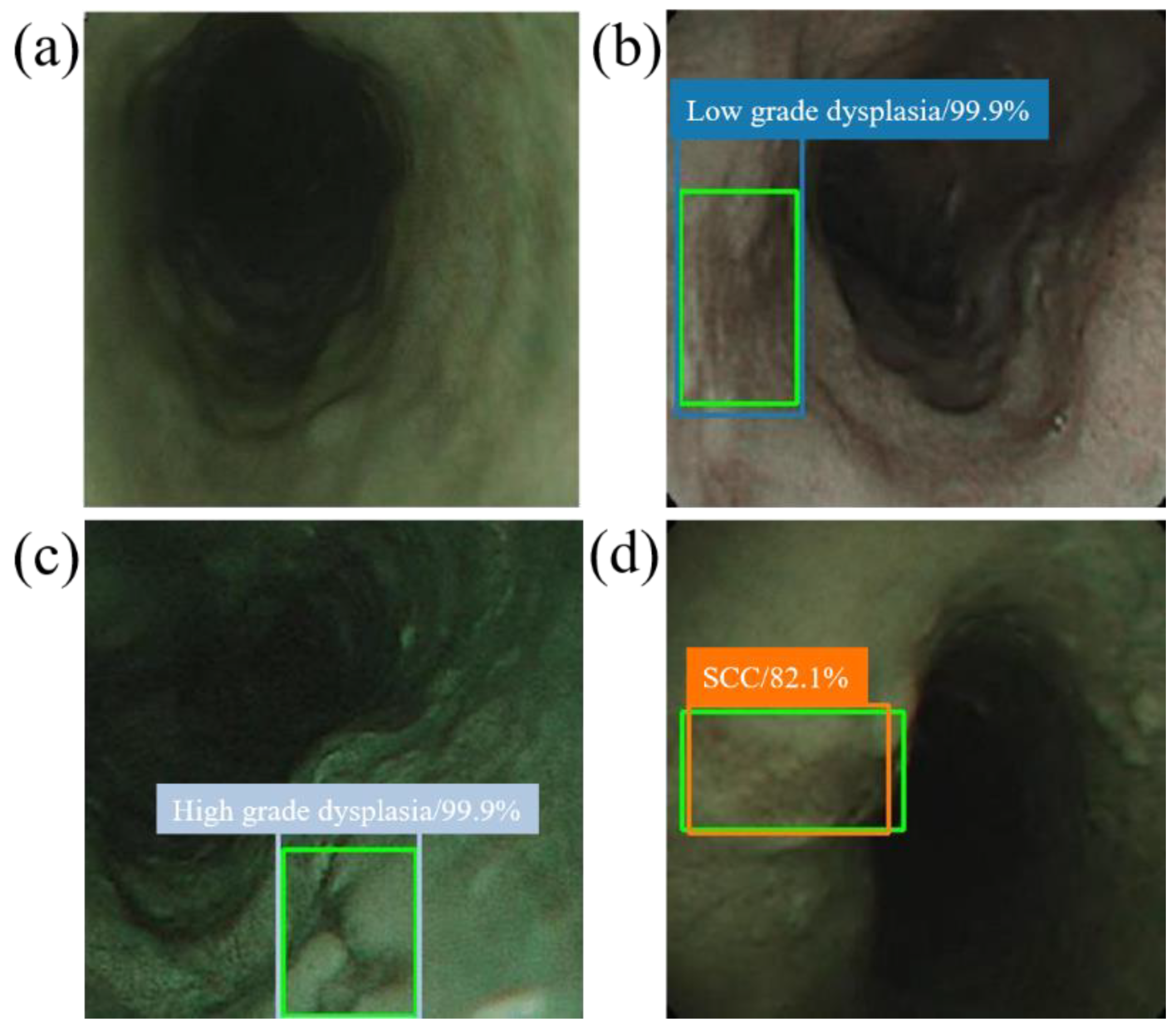 Cancers 13 00321 g005