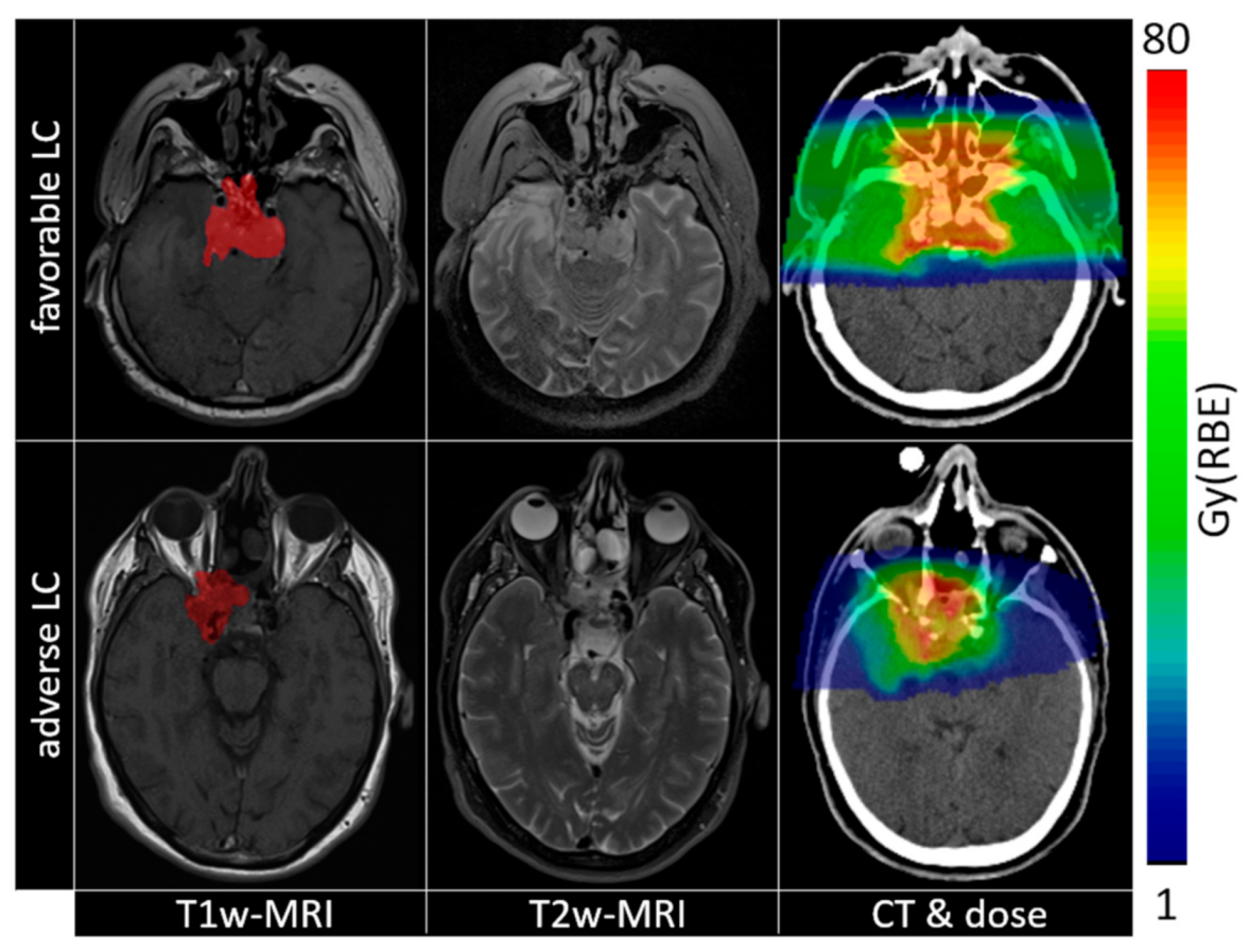 Cancers 13 00339 g003