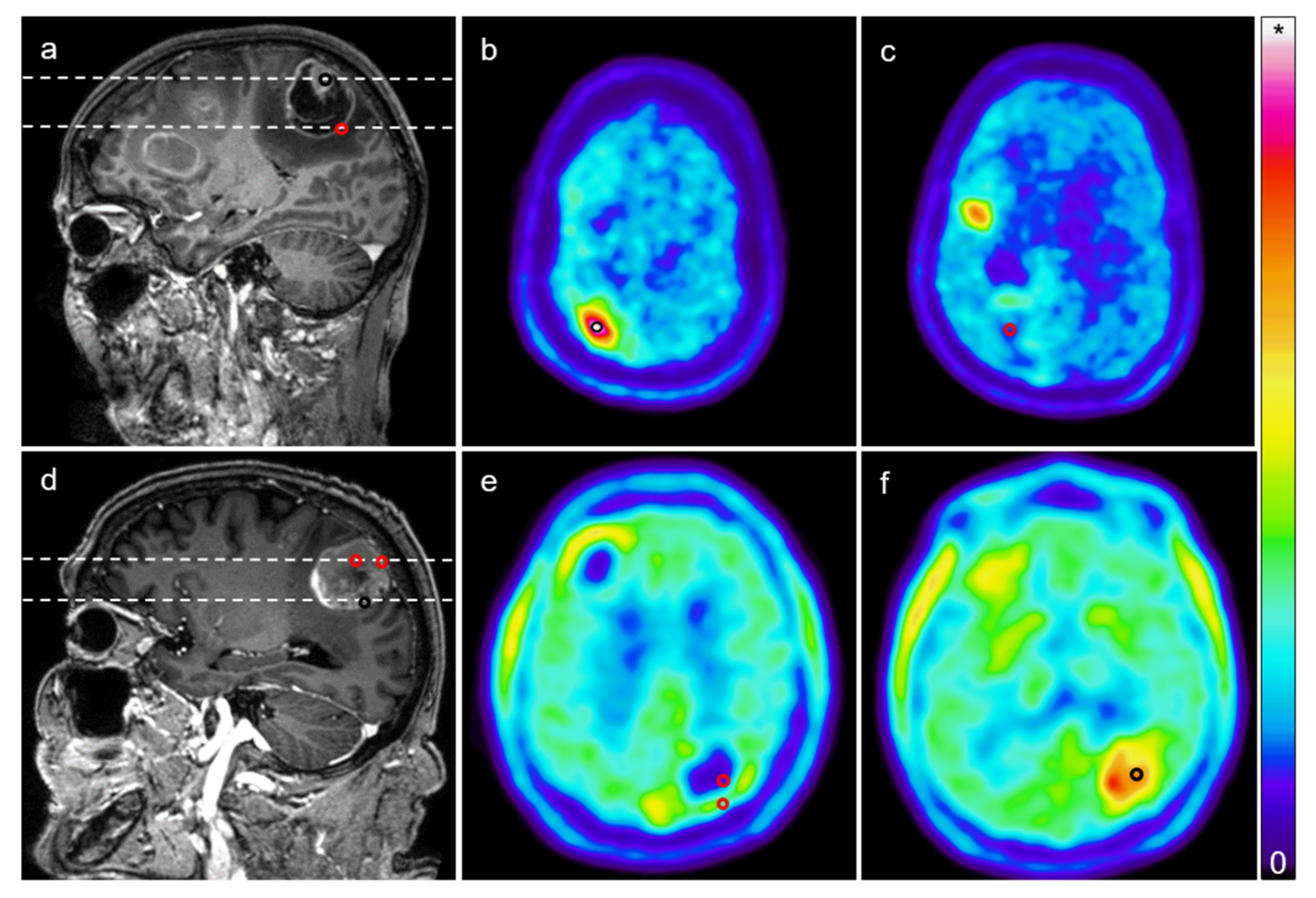Cancers 13 00355 g001 Cancers 13 00355 g001