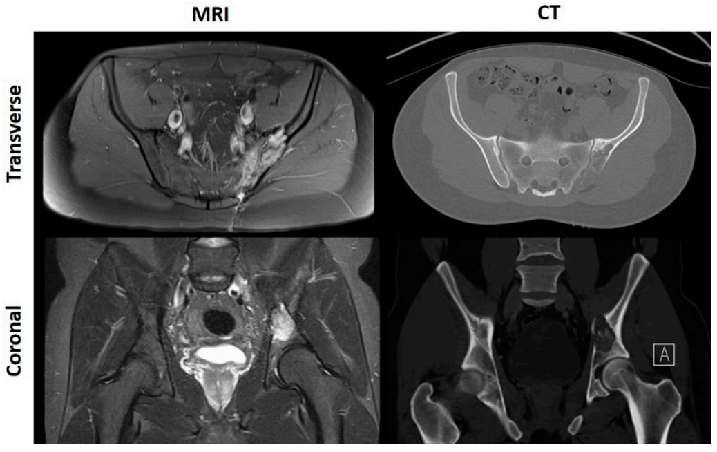 Cancers 13 00388 g001