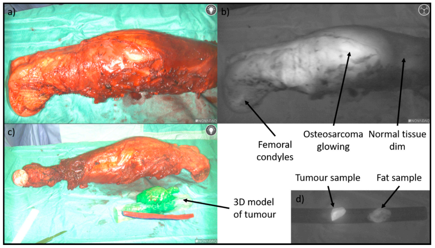 Cancers 13 00388 g002