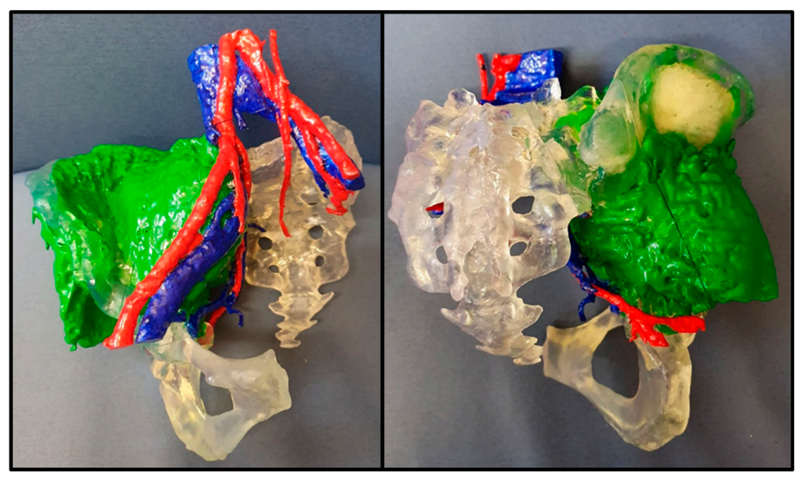 Cancers 13 00388 g007