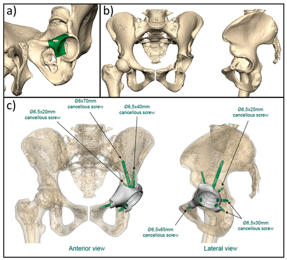Cancers 13 00388 g008