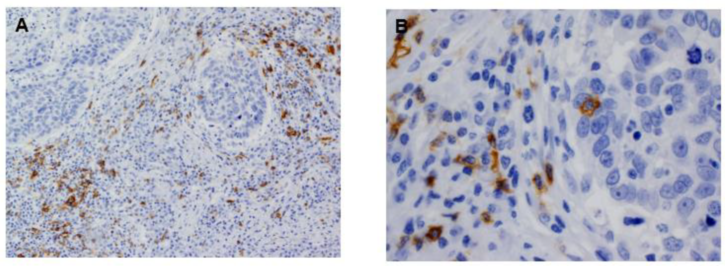 Cancers 13 00395 g001 Cancers 13 00395 g001