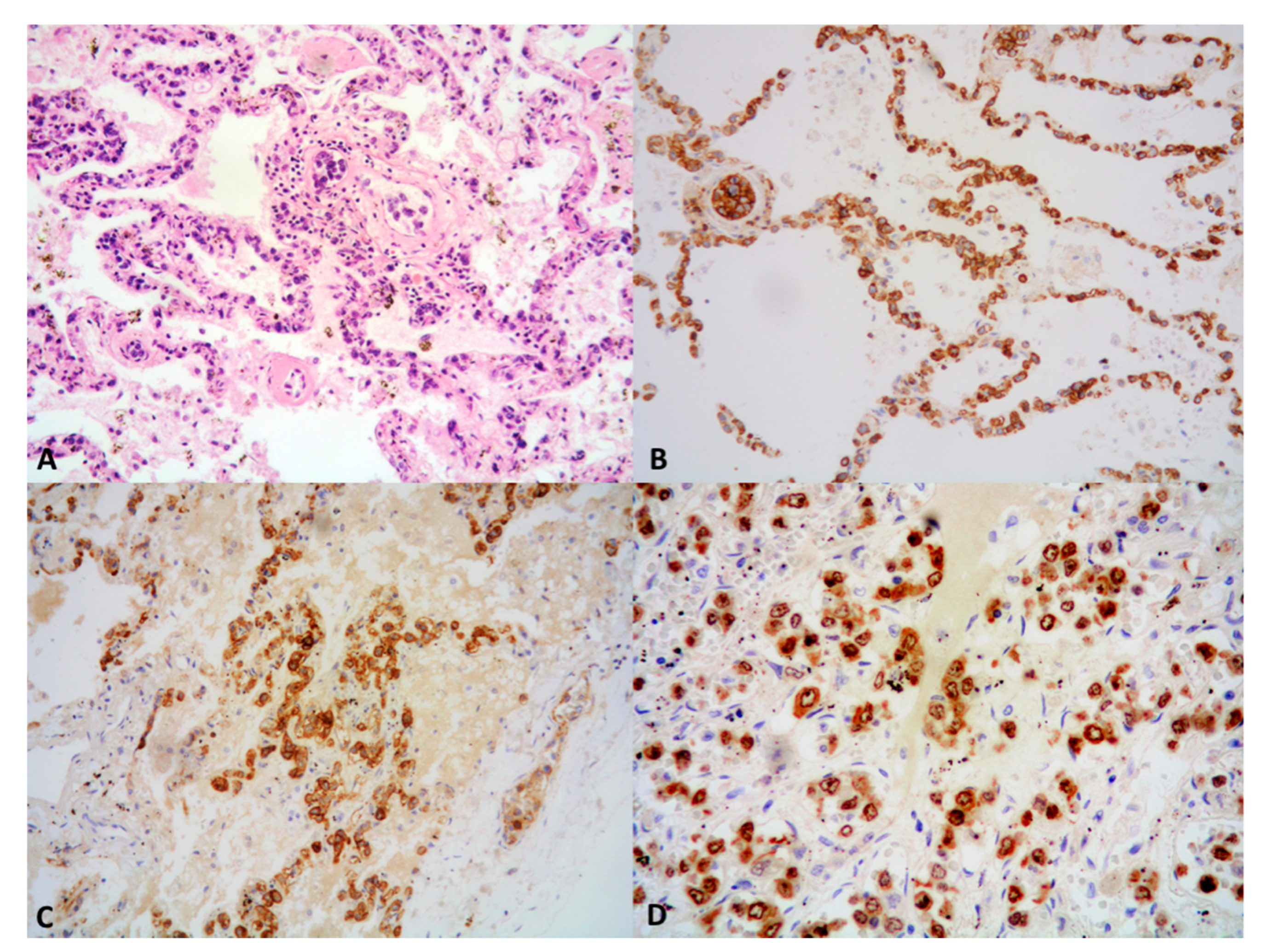 Cancers 13 00415 g006