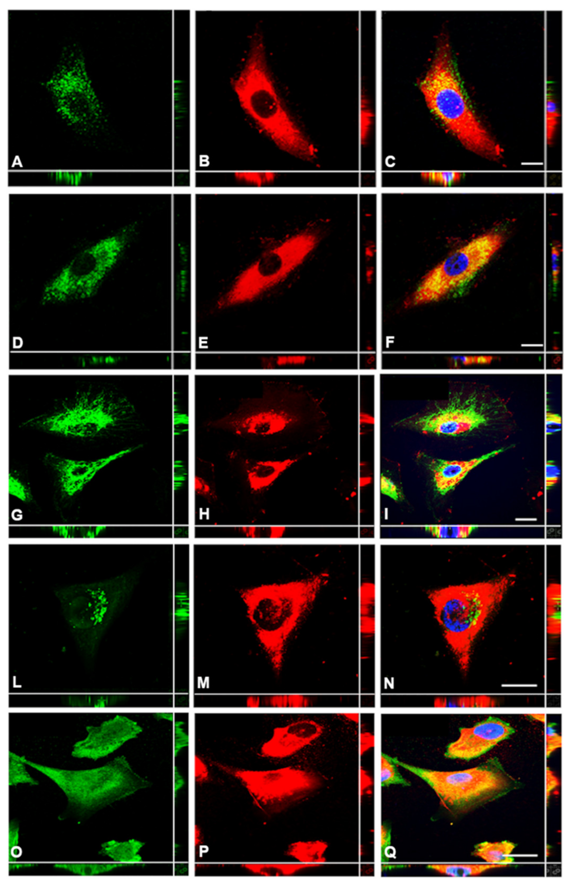 Cancers 13 00416 g004 Cancers 13 00416 g004