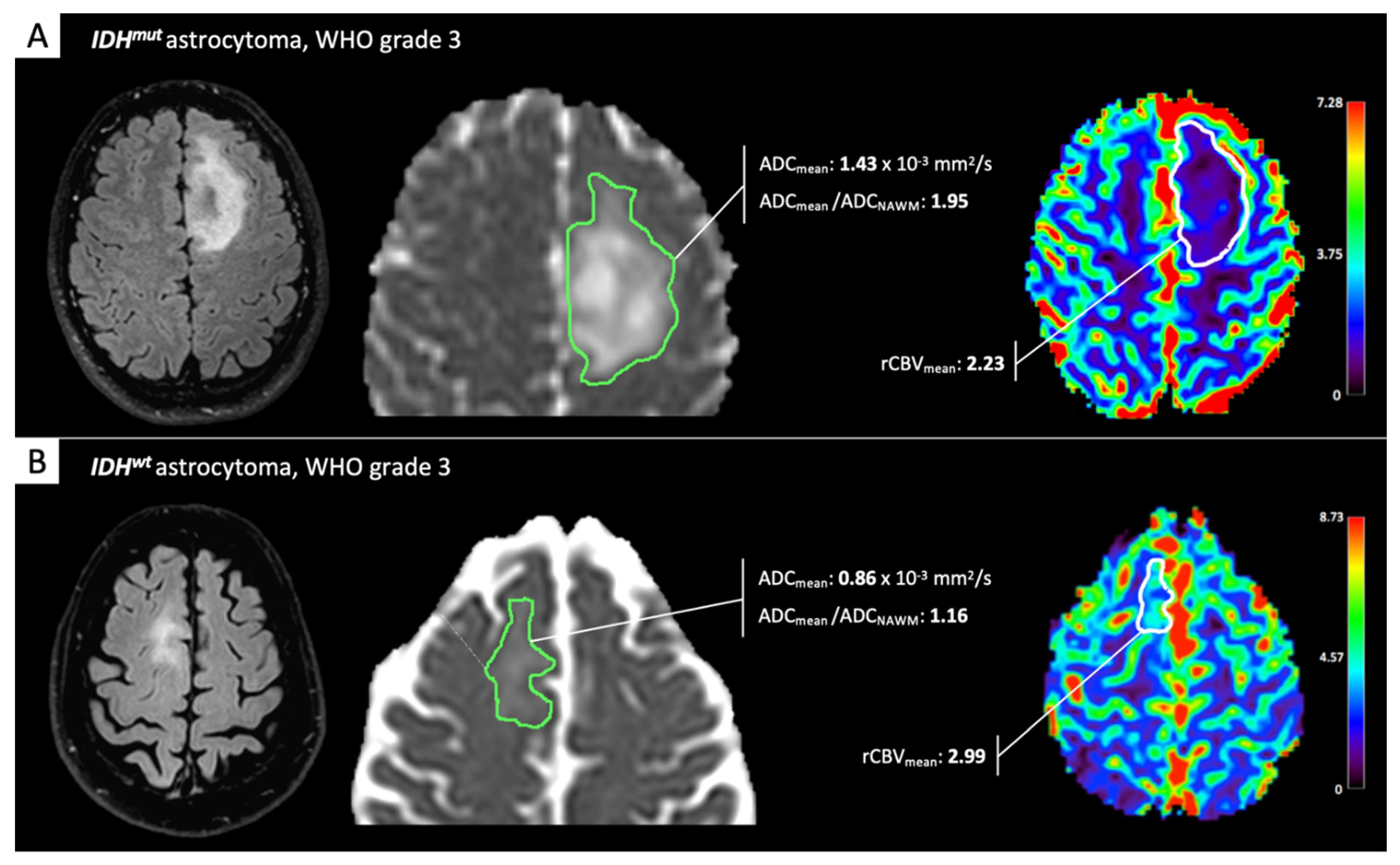 Cancers 13 00424 g001 Cancers 13 00424 g001