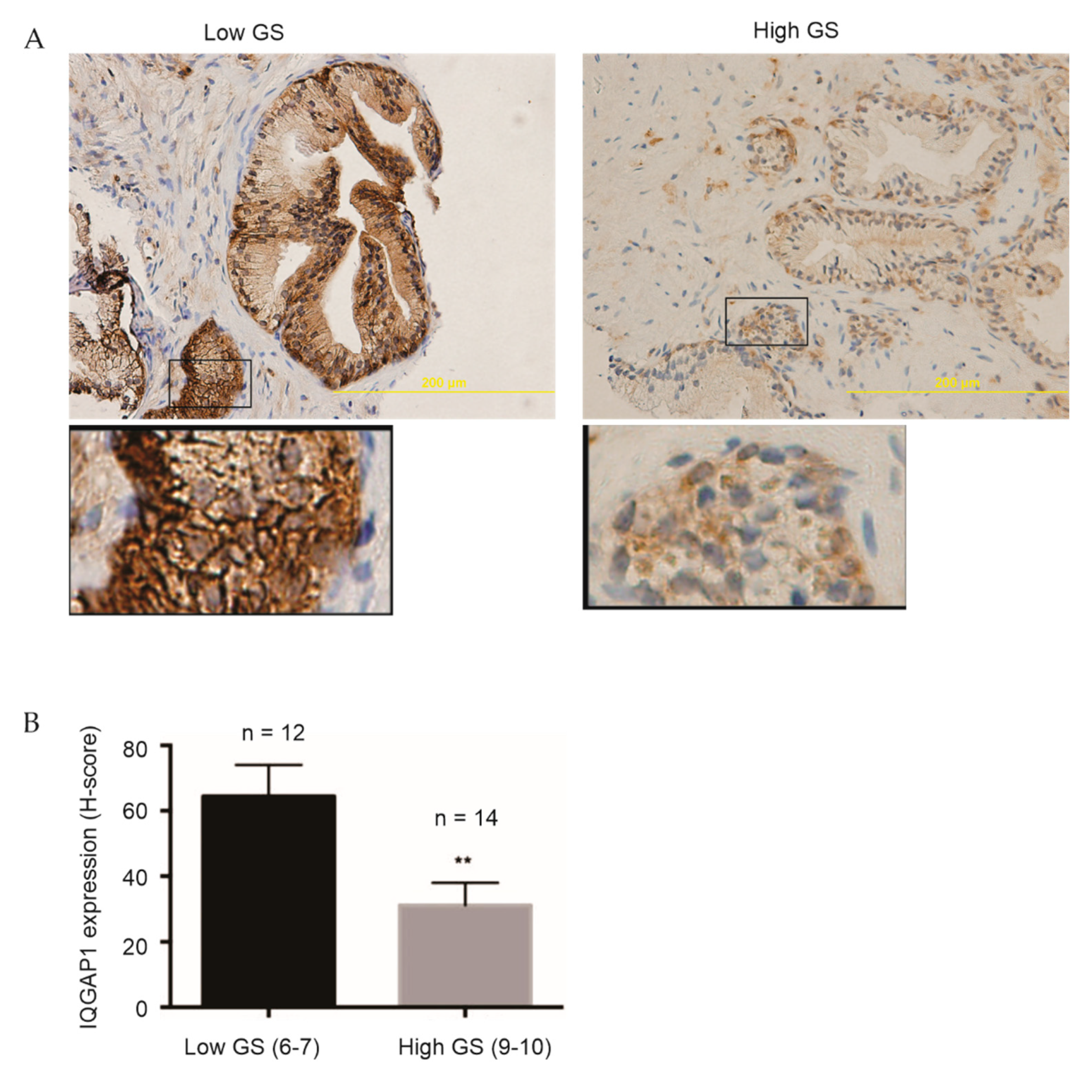 Cancers 13 00430 g001