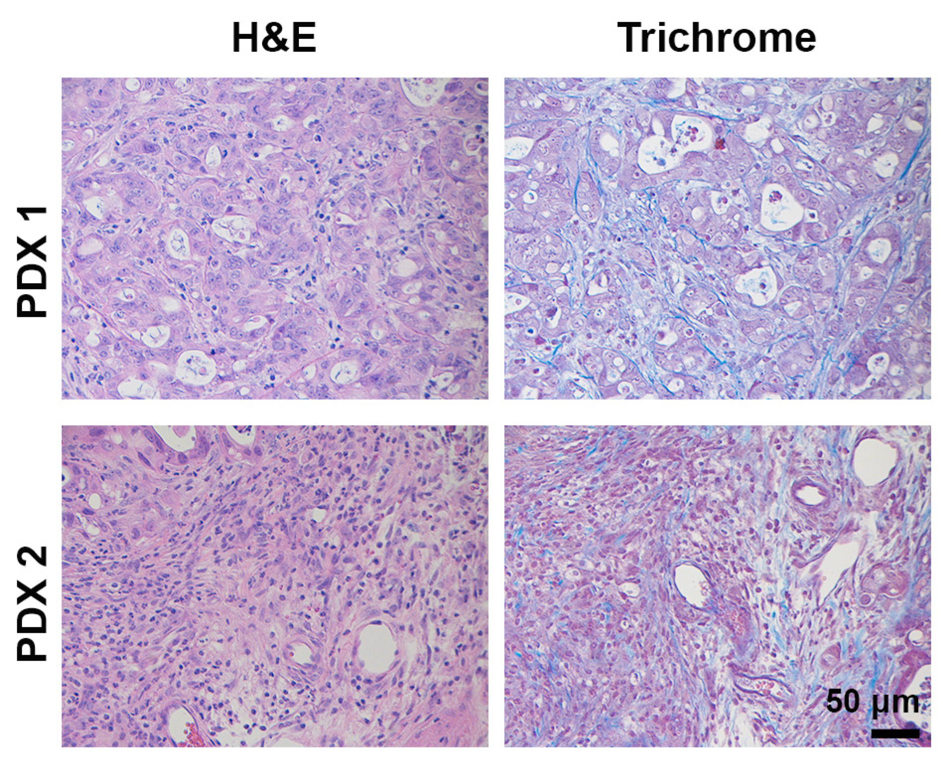 Cancers 13 00440 g005