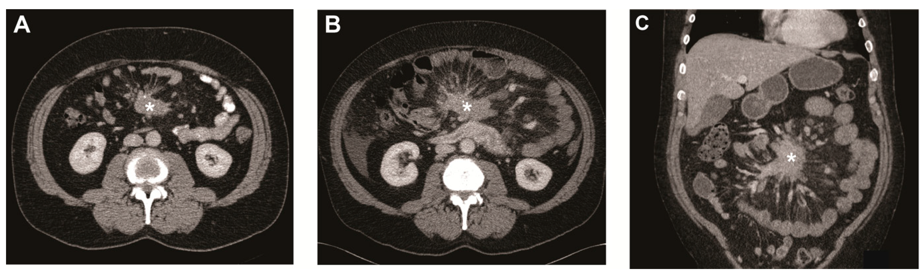 Cancers 13 00443 g001